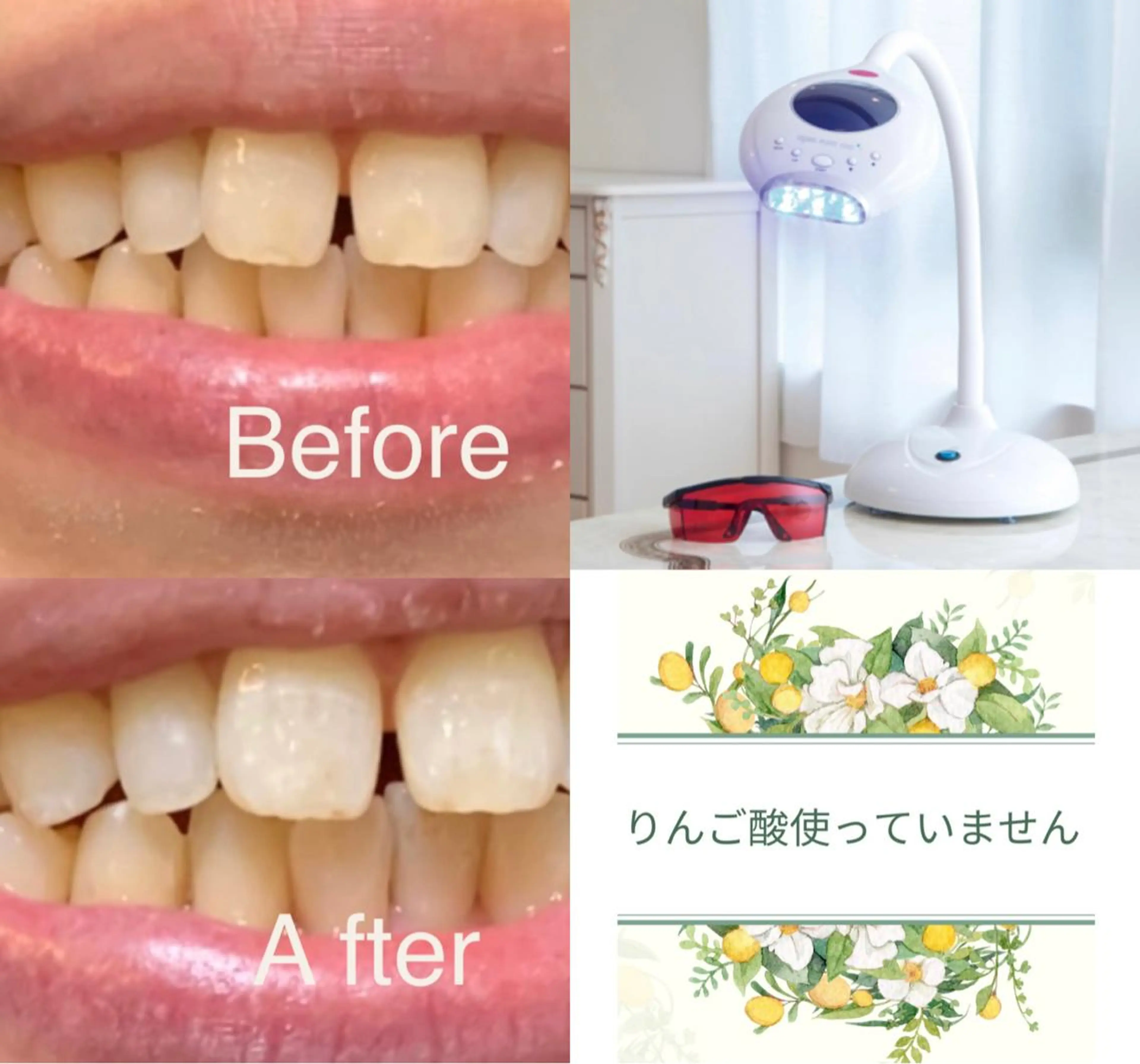 整体フェイシャル EMINALのエステ・リラクイメージ