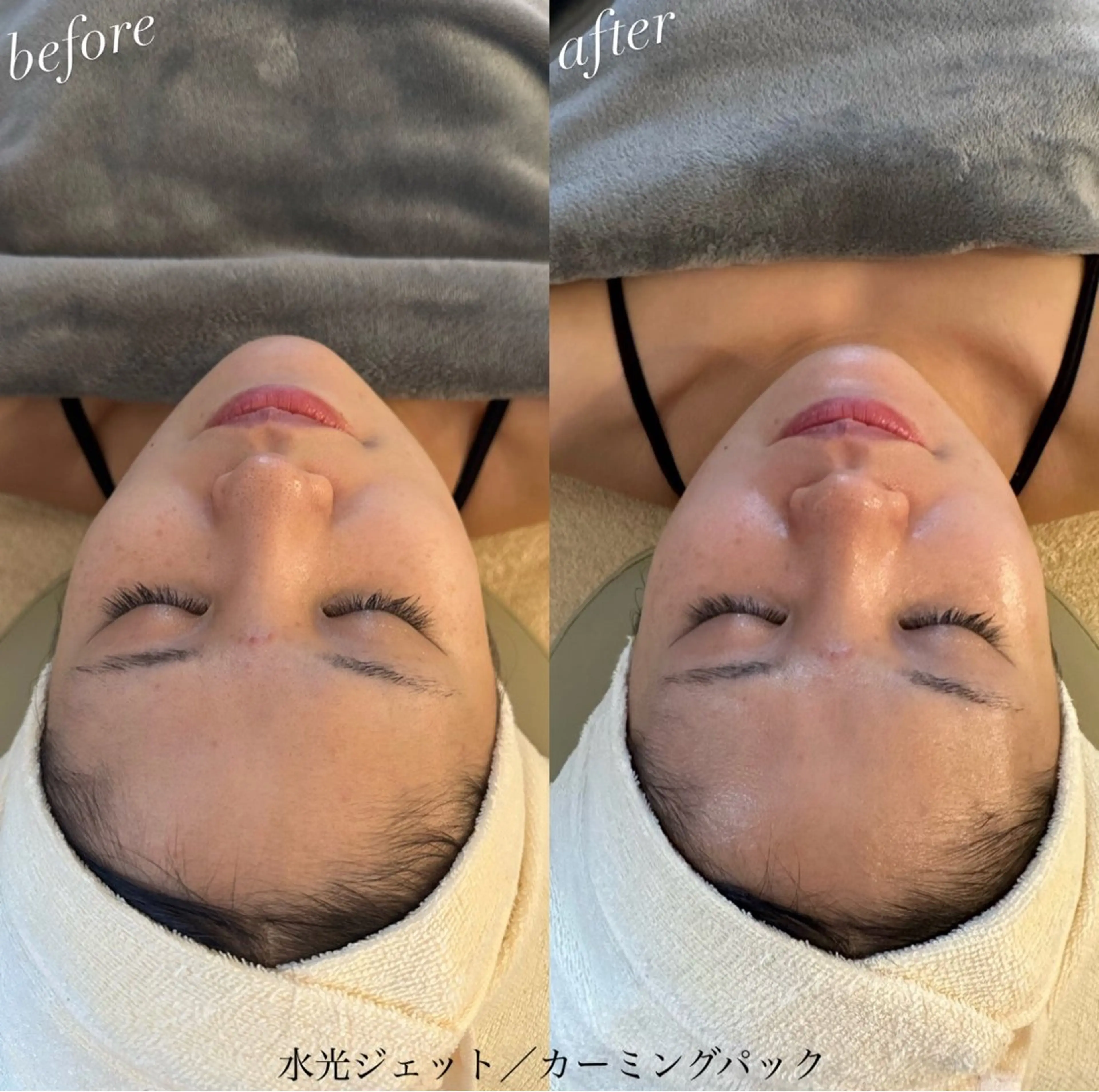 エステ うなじ脱毛/美肌脱毛 LABELのエステ・リラクイメージ