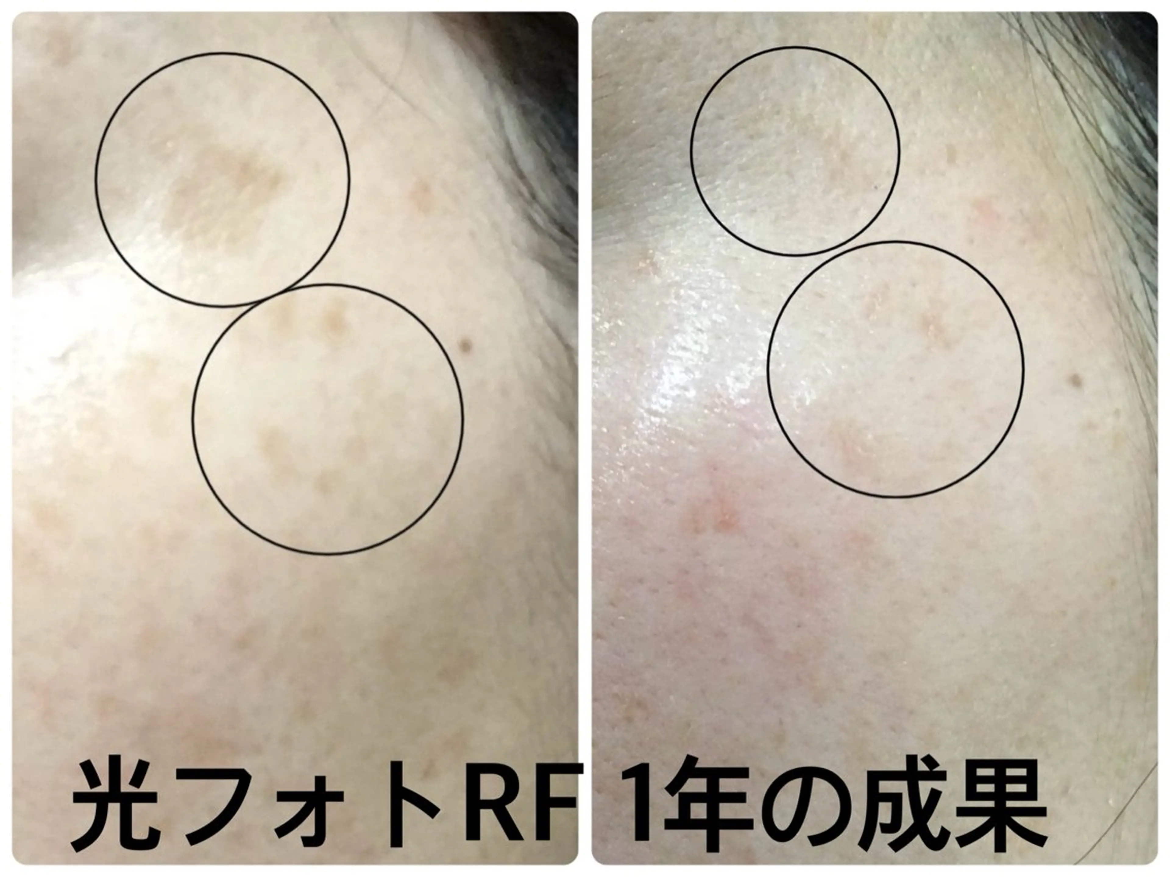 private salon OUKA所属・OUKA脱毛 毛穴ケアフェイシャルのエステ・リラクイメージ