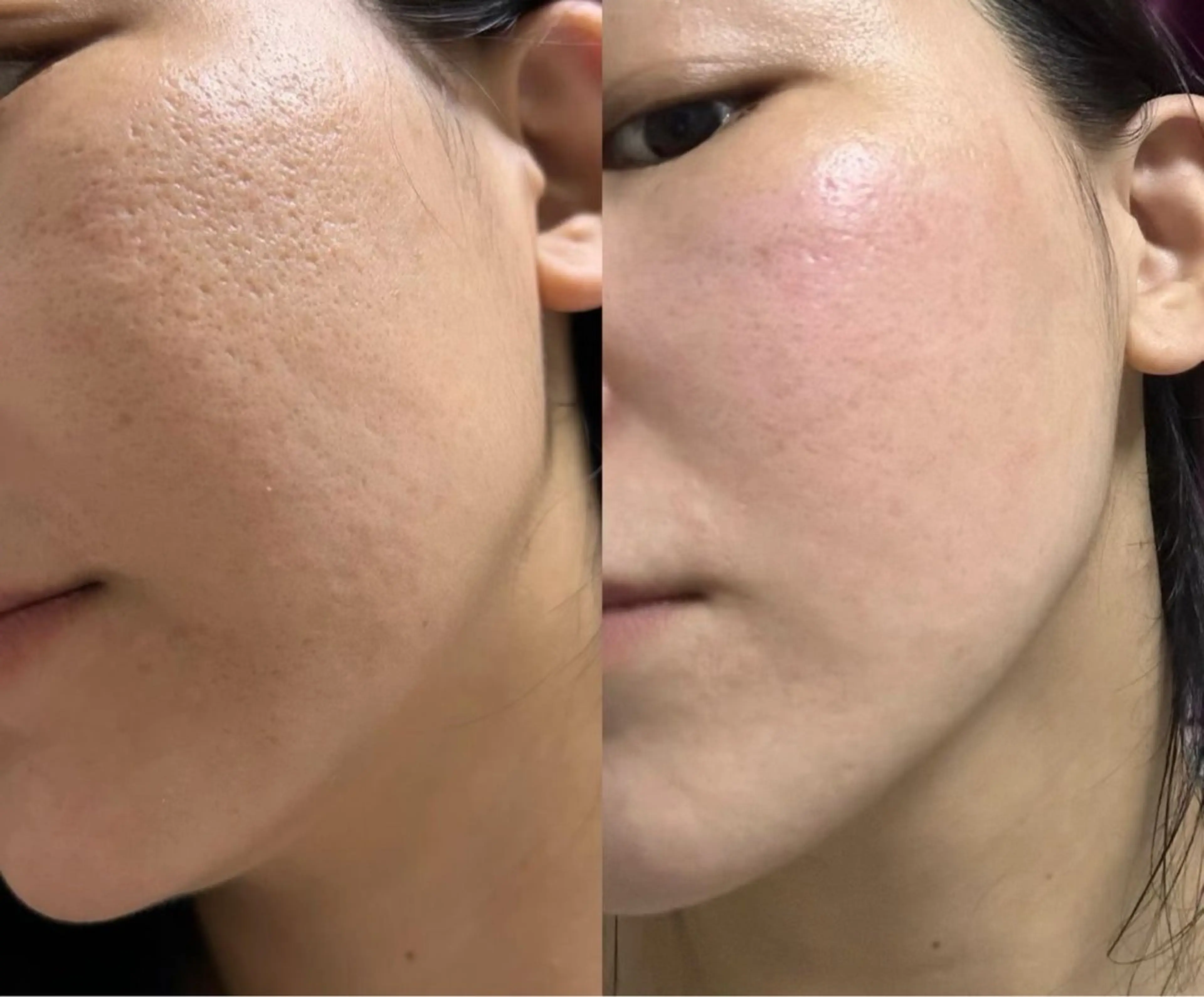 マツエク・マツパ エステ aliaハイフ&水光ジェットサロン所属・aliaハーブ水光店 エステティシャン募集のエステ・リラクイメージ