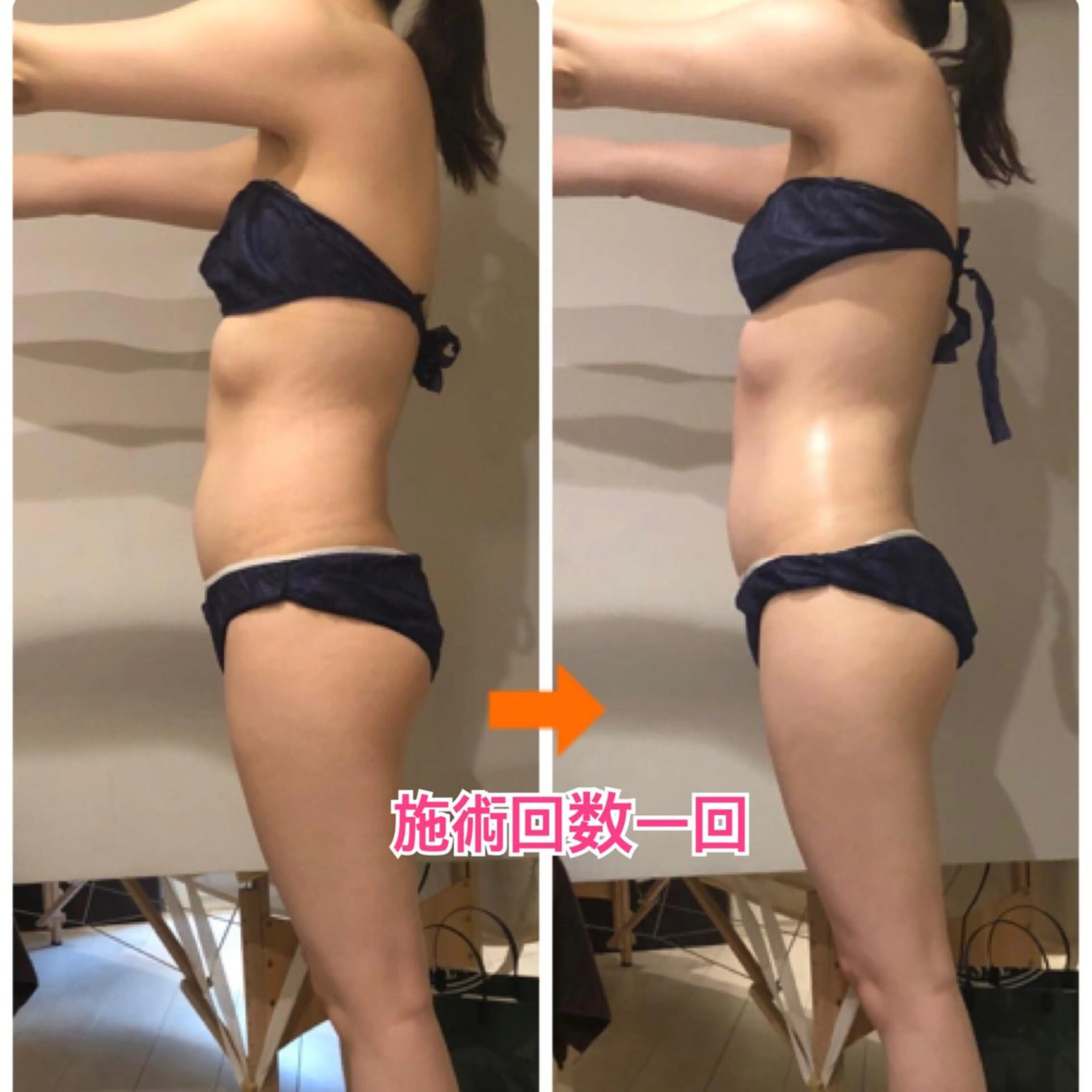 ショート カラー パーマ ヘアアレンジ メンズ キッズ ネイル マツエク・マツパ ‍痩身＆ボディ 結果出し🌟丹野のエステ・リラクイメージ