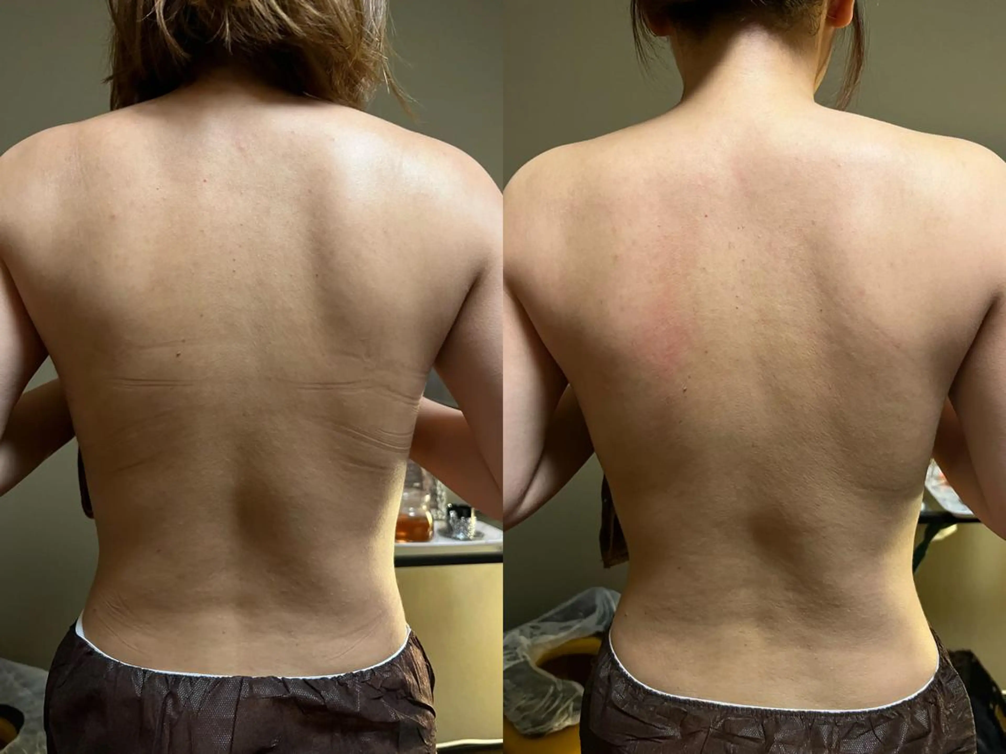 エステ リラク lymph care 'Welnəsのエステ・リラクイメージ