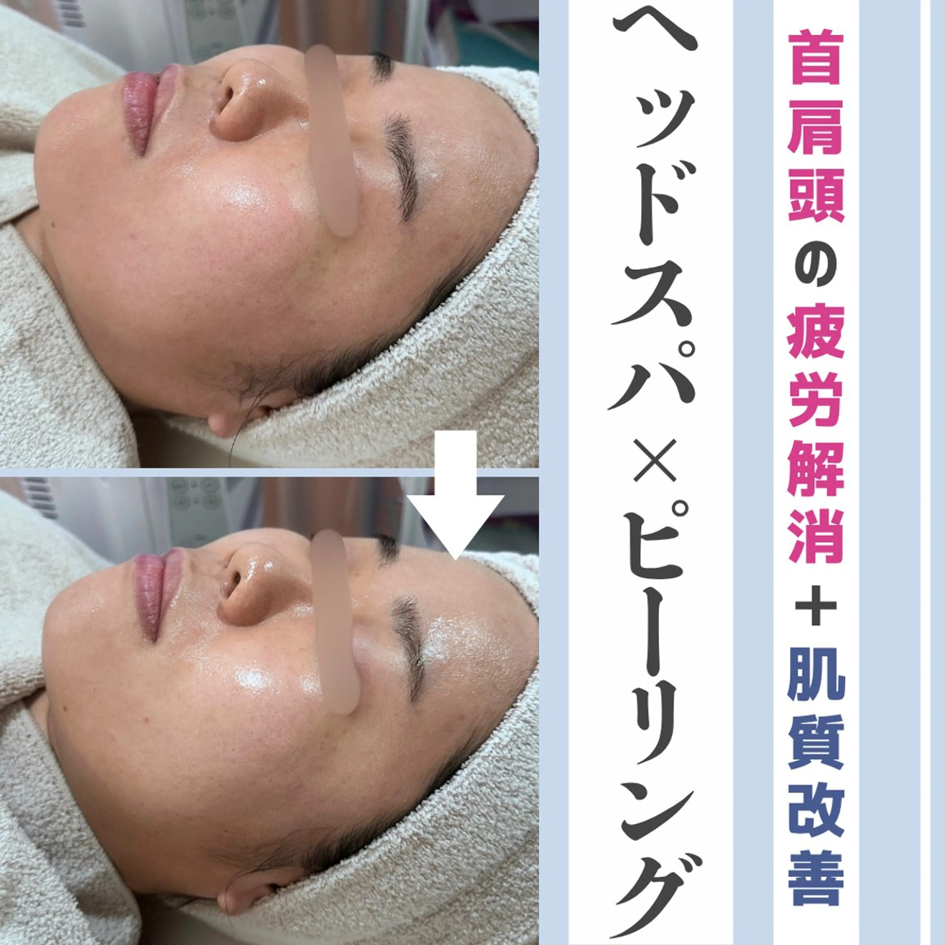 〈NEW🩵〉お好きなピーリング➕ドライヘッドスパ20分🫧の写真