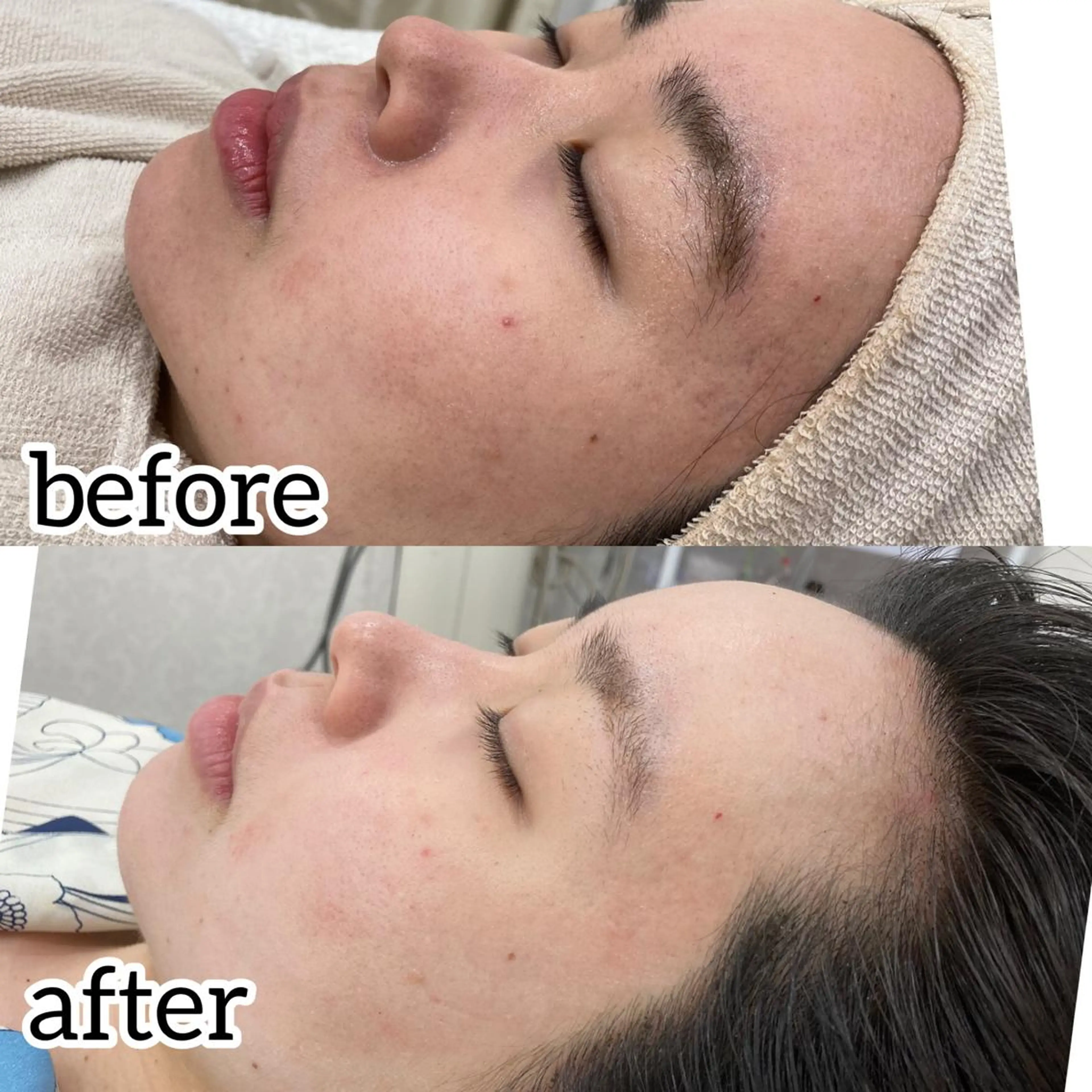 laluna saki...のその他イメージ