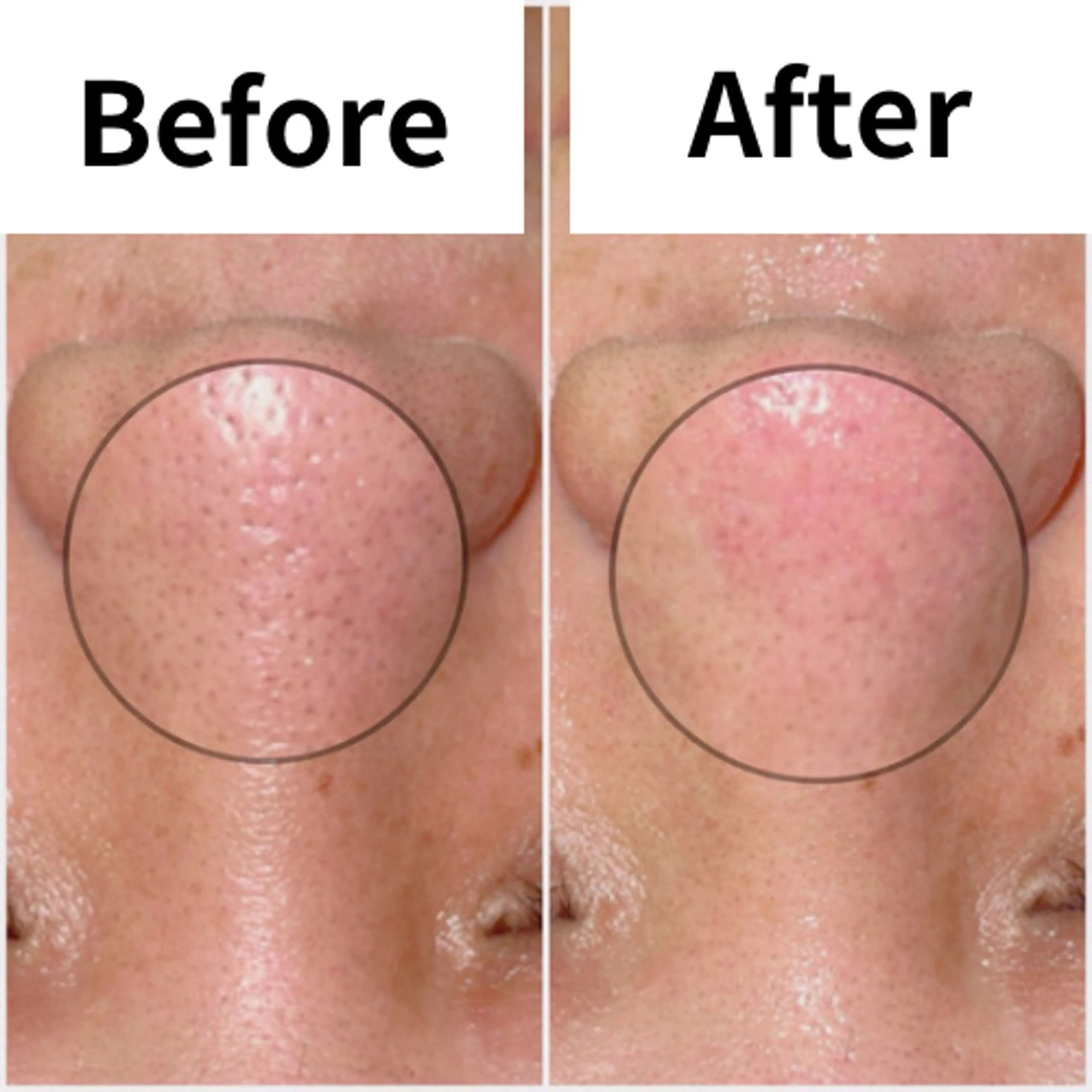 エステ SELF  BEAUTY gracia浦添店所属・gracia 浦添店のその他イメージ