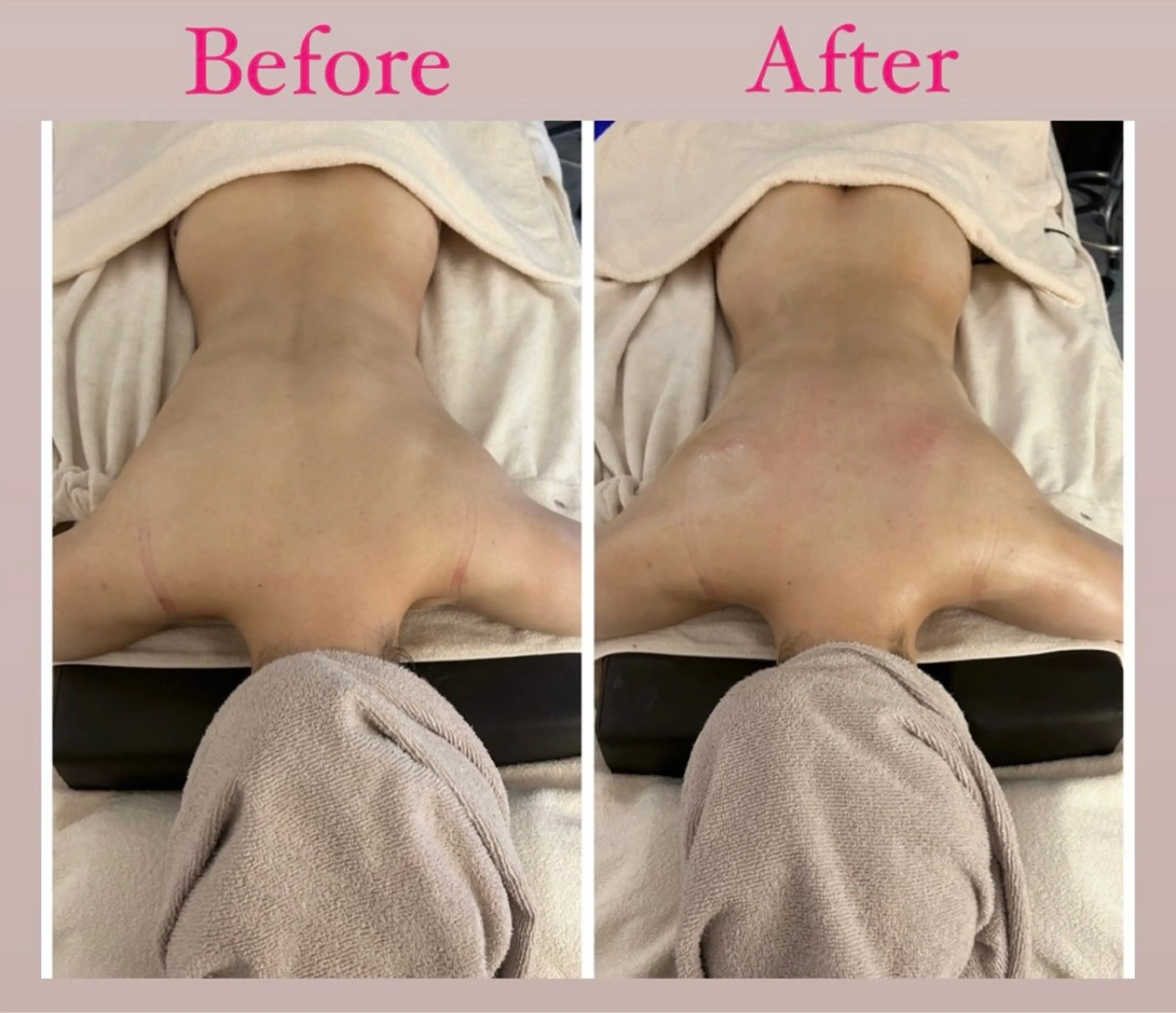 エステ ブライダルエステ&肌管理OGUMO所属・肌管理 OGUMOのエステ・リラクイメージ