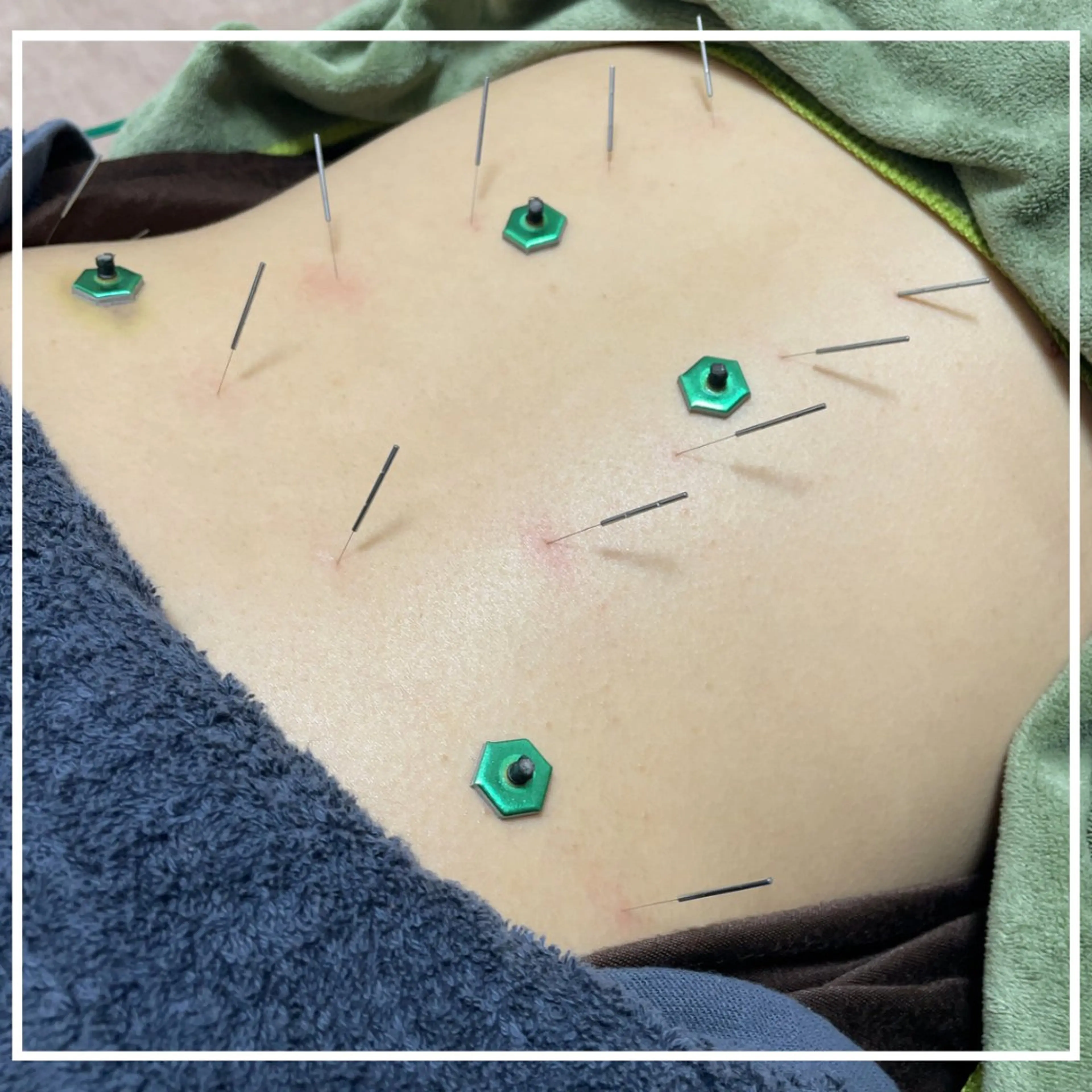 首肩こり、腰痛、足の疲れなど体の不調を改善【お身体のみのケア】の写真