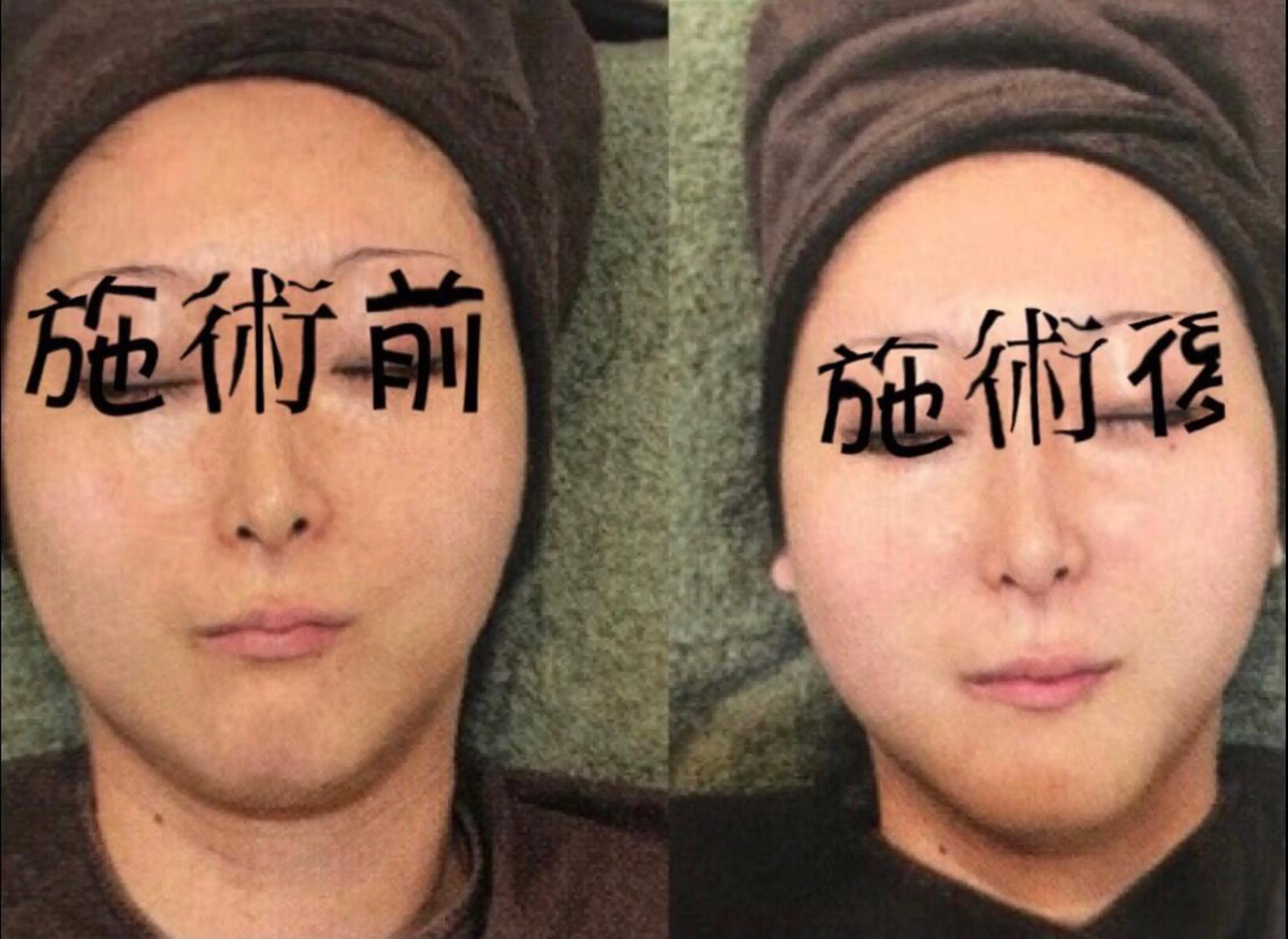 美容医療提携 サロンドシェリーのエステ・リラクイメージ