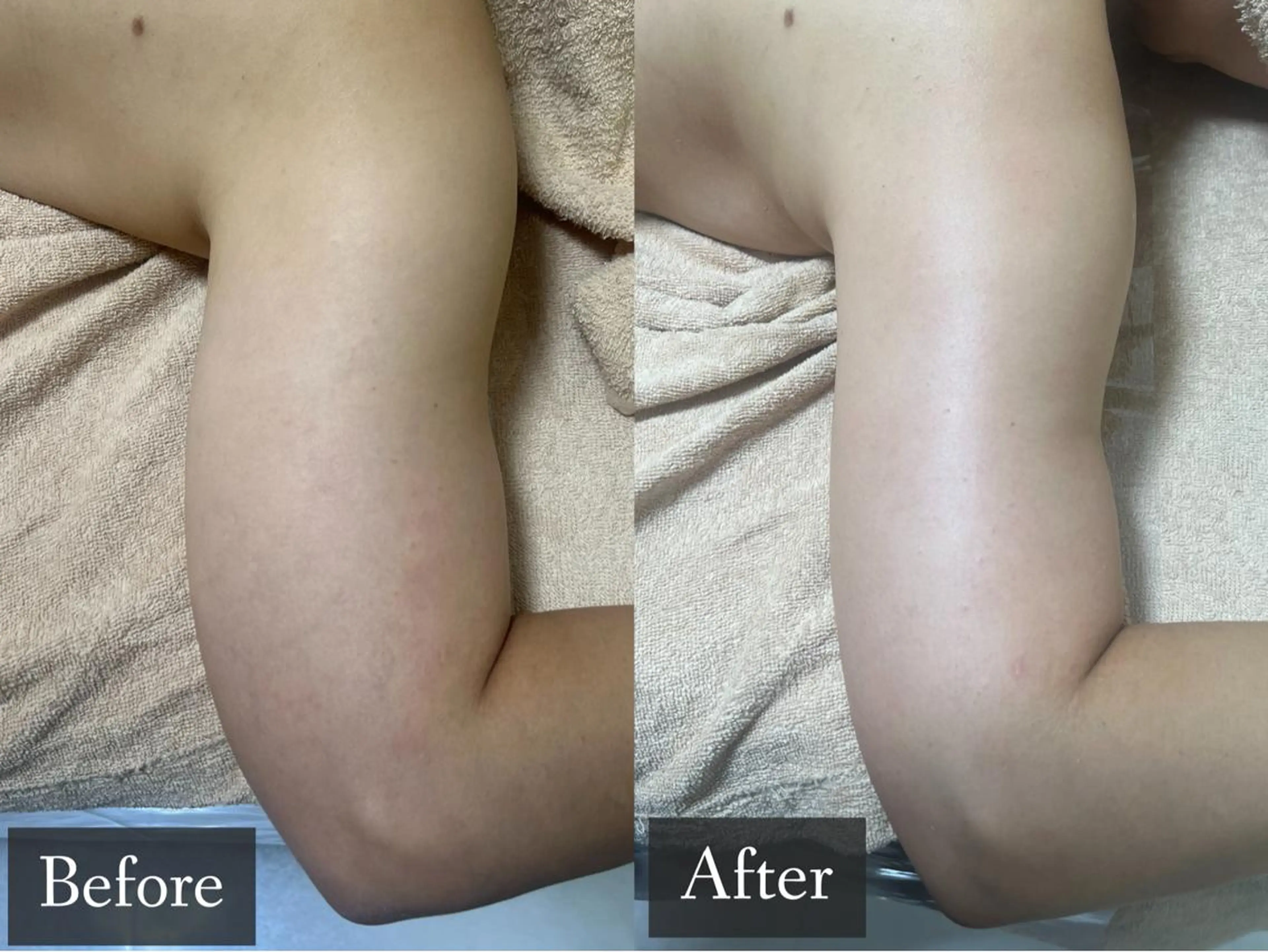 脱毛専門サロン BELFINE恵比寿のエステ・リラクイメージ