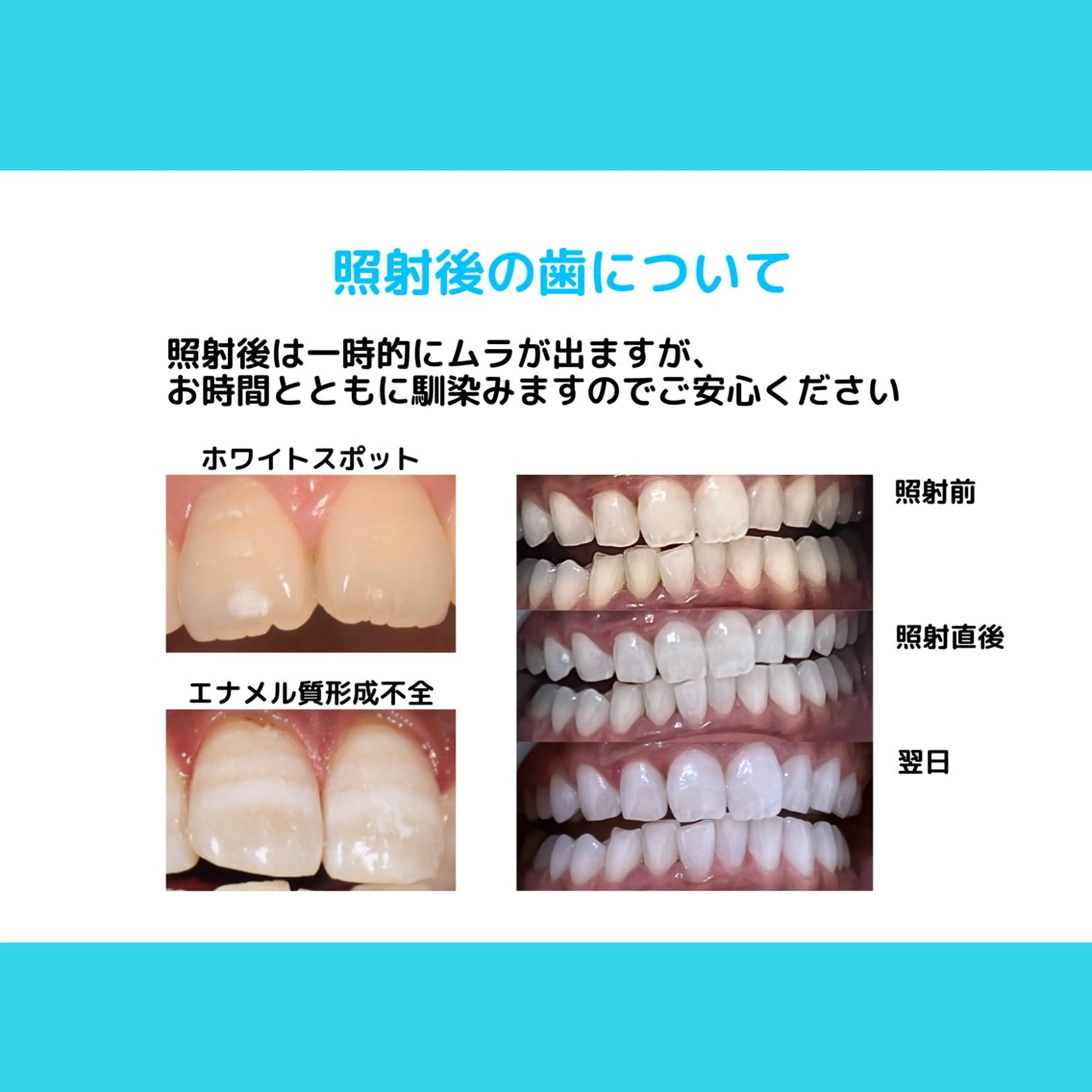 ホワイトニング ショップ多摩店のその他イメージ