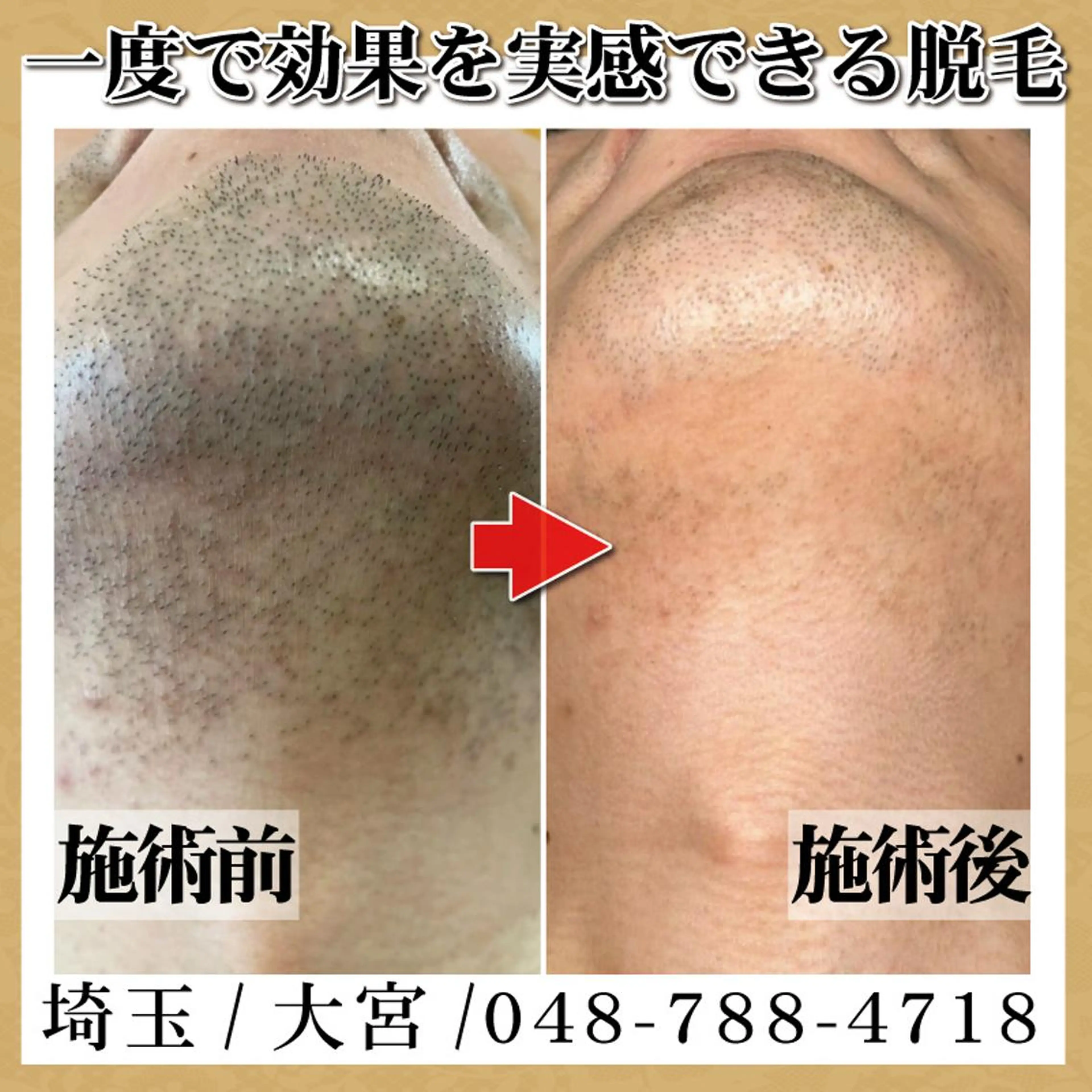 脱毛＆フェイシャル TOWA大宮のエステ・リラクイメージ