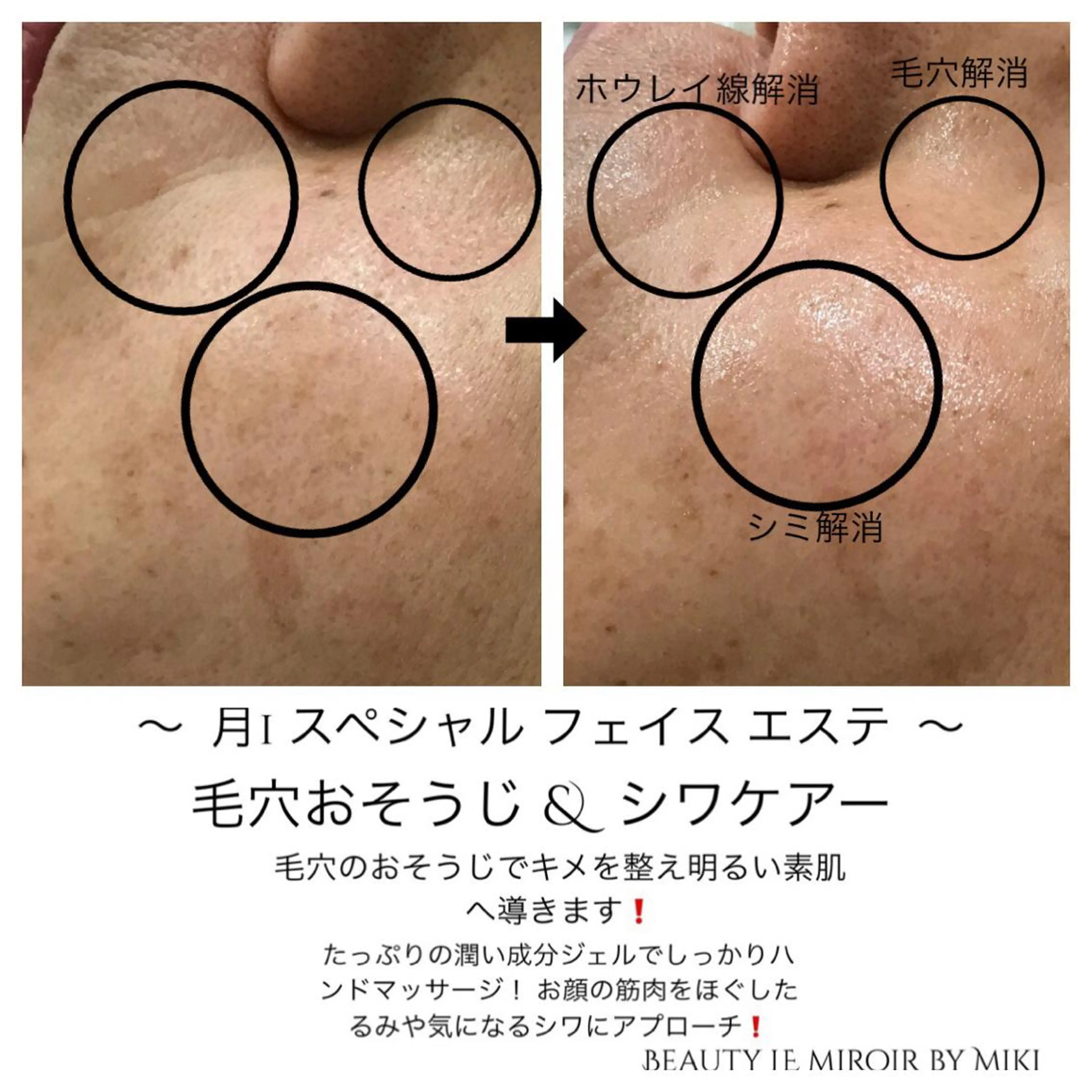 ビューティー ミロワールのエステ・リラクイメージ