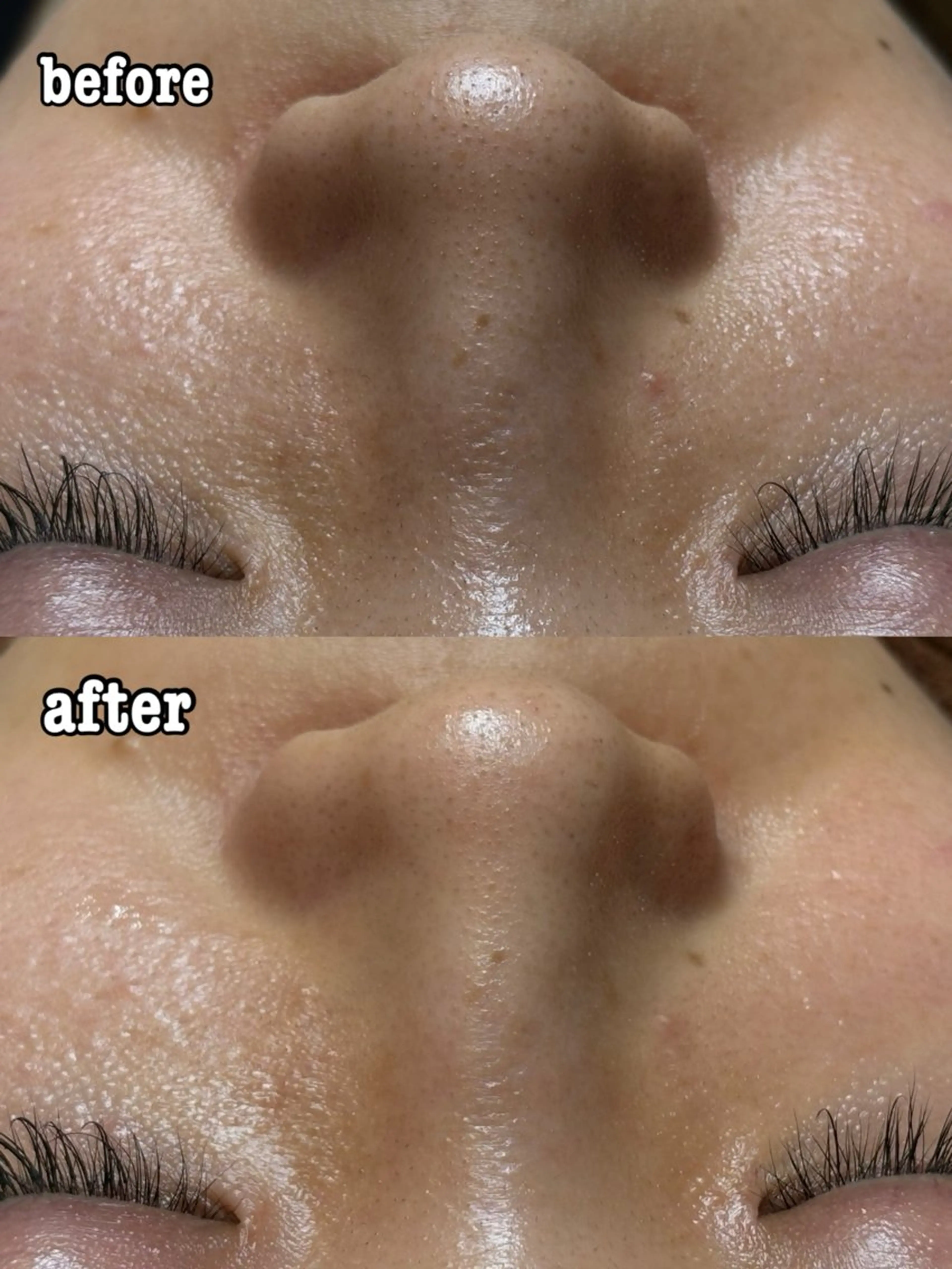 Minnat所属・小林 里菜のエステ・リラクイメージ