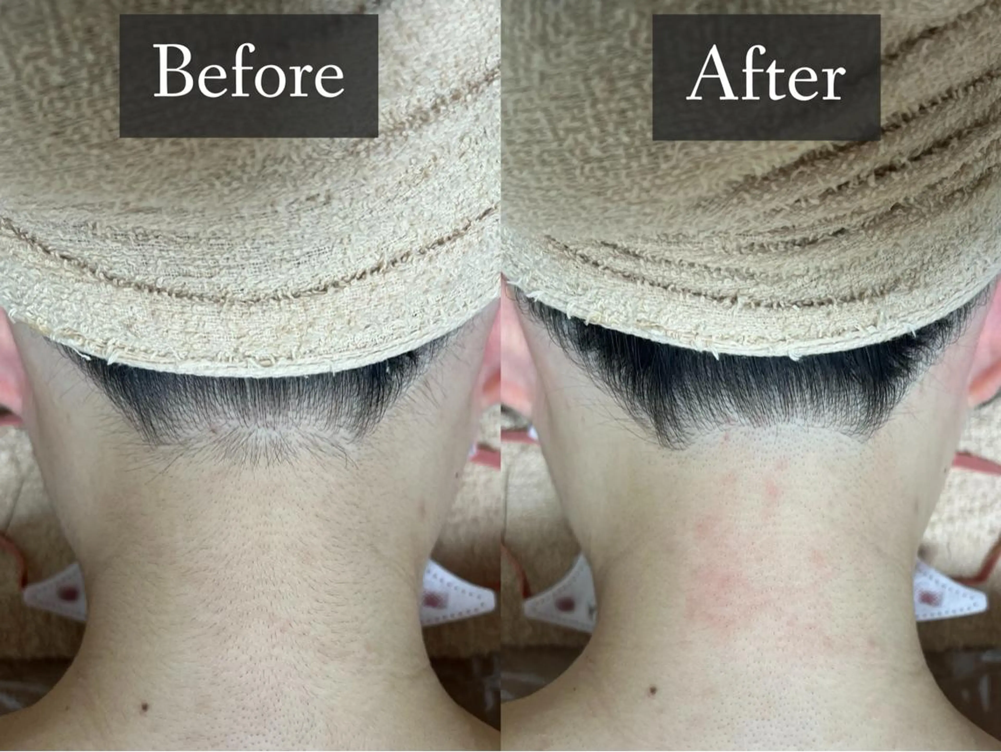 脱毛 脱毛専門サロン BELFINE恵比寿のエステ・リラクイメージ