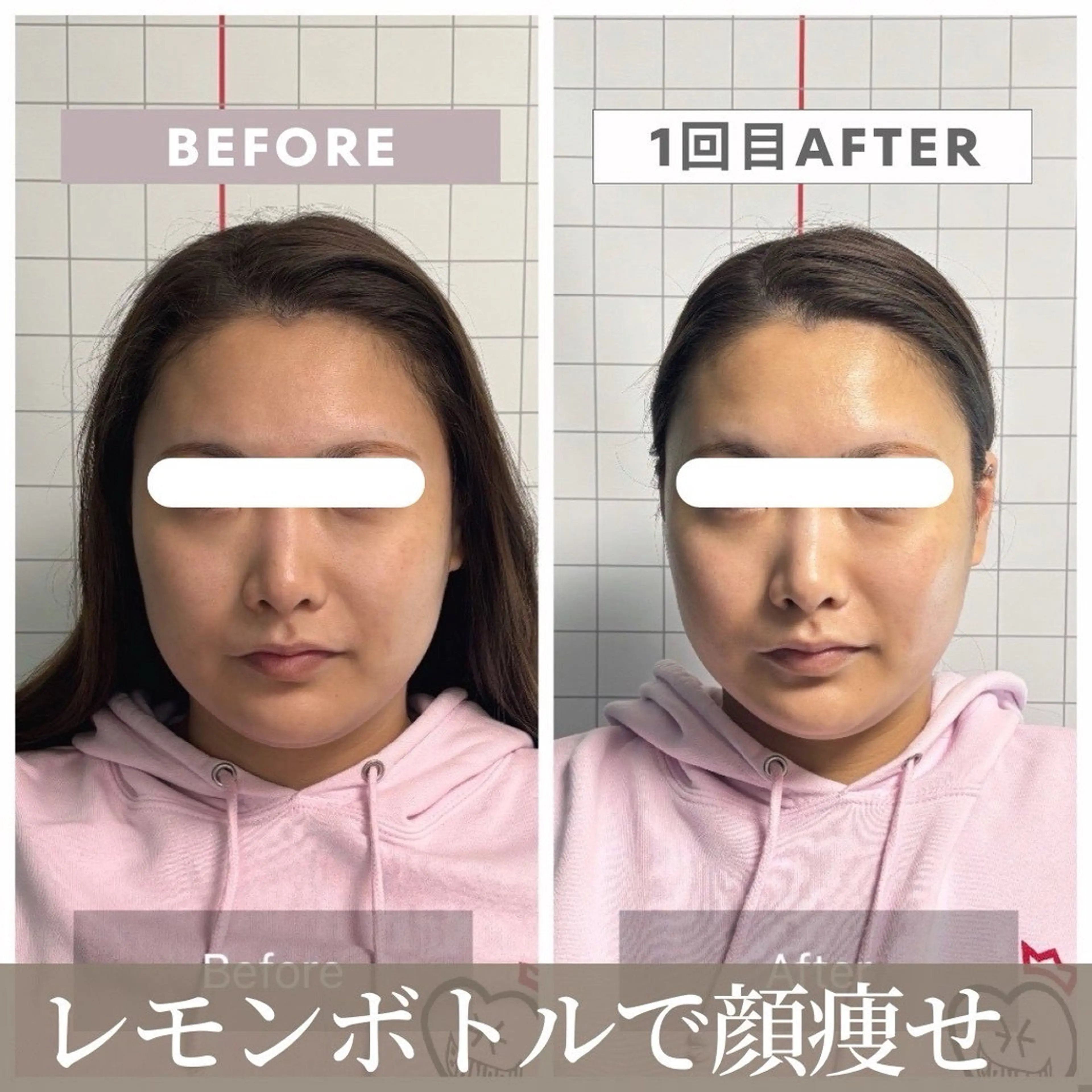 エステ リラク 【小顔リフト×小顔矯正専門店】RED所属・猿渡 ひかるのエステ・リラクイメージ