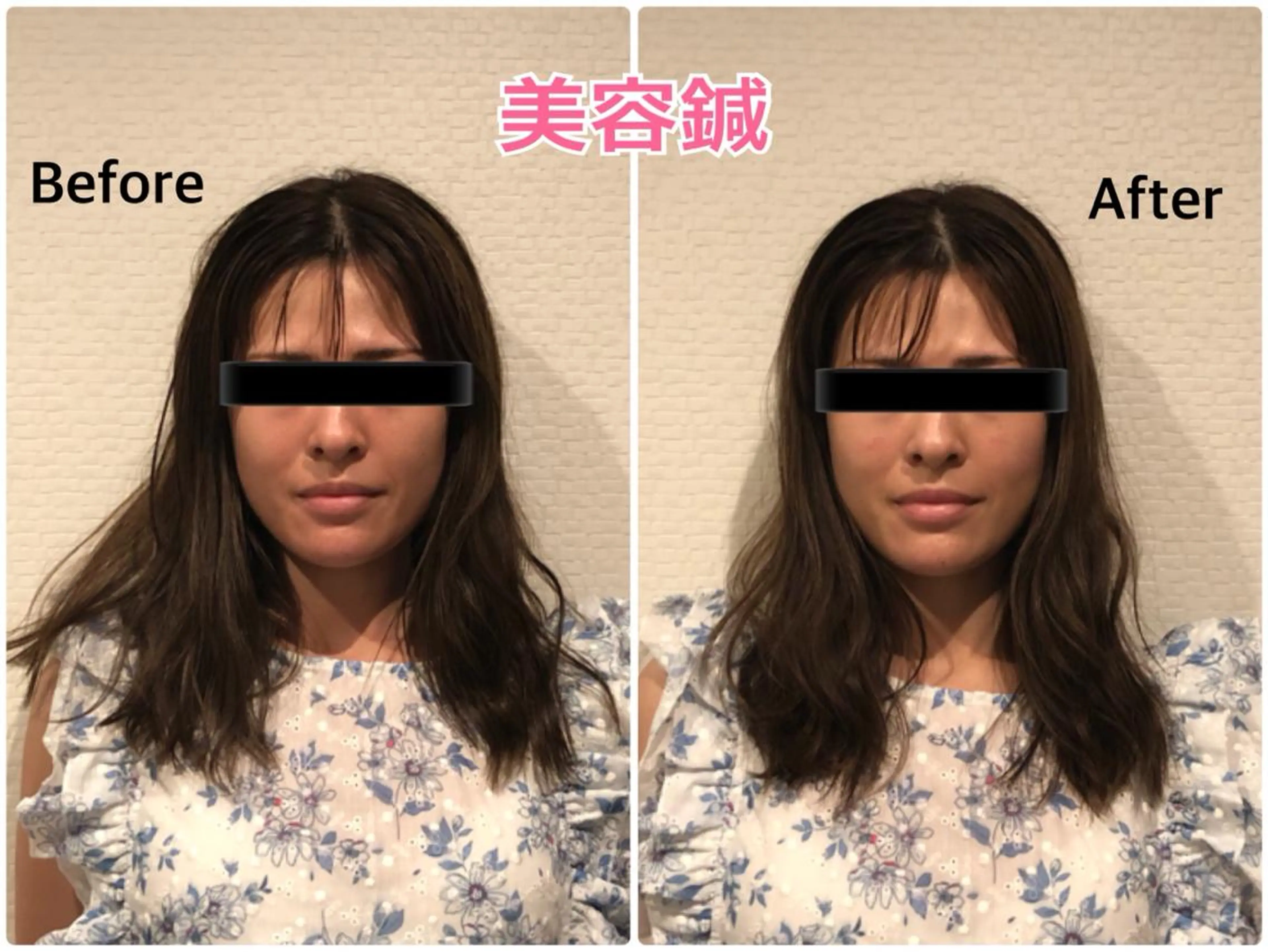 エステ チキバン美容鍼灸整体 サロン心斎橋店のエステ・リラクイメージ