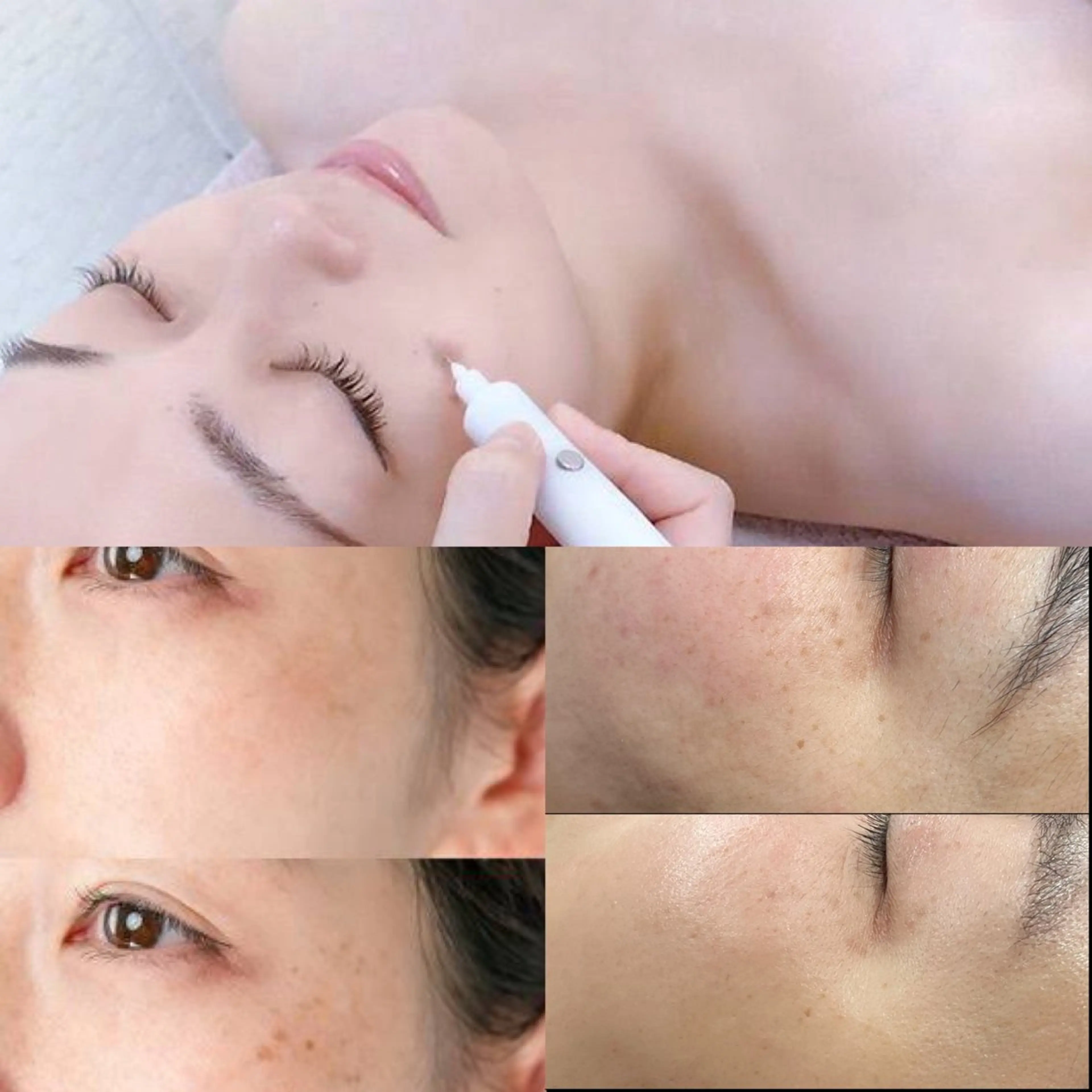 LiZA エステティックサロンのエステ・リラクイメージ