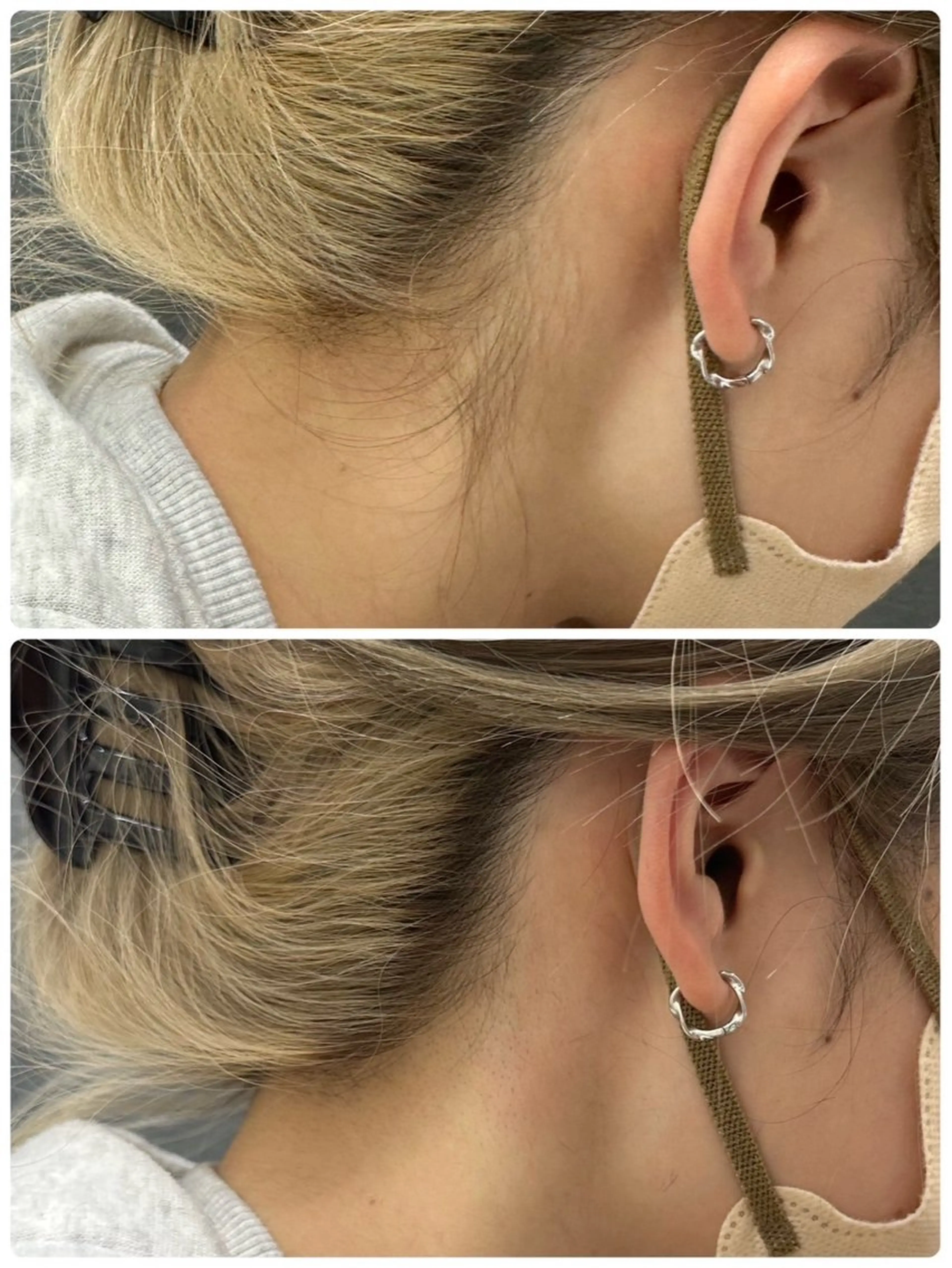 ◯△□所属・最新美肌脱毛 韓国水光肌🫧のその他イメージ