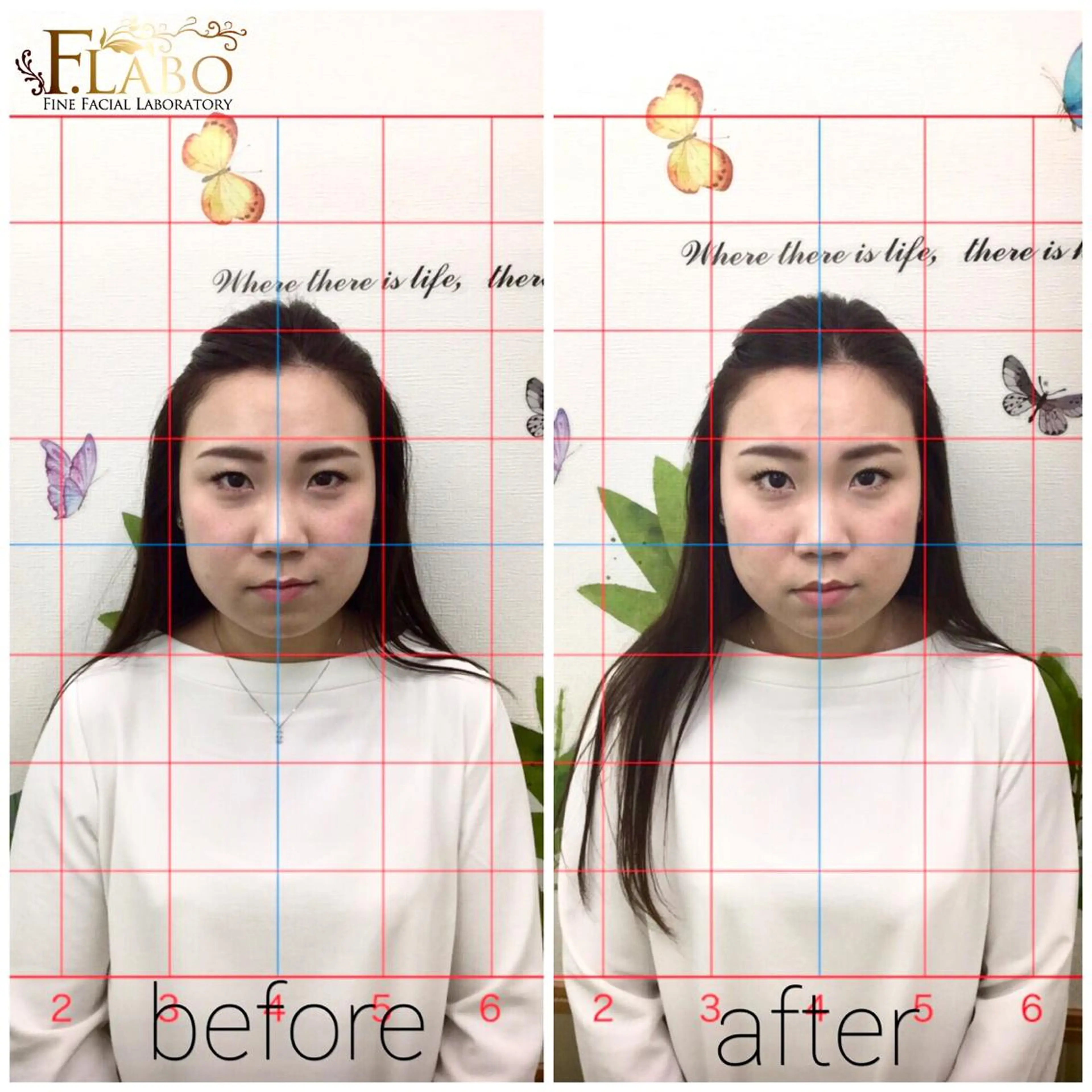 小顔&ダイエットジム エステ担当REIKOのその他イメージ