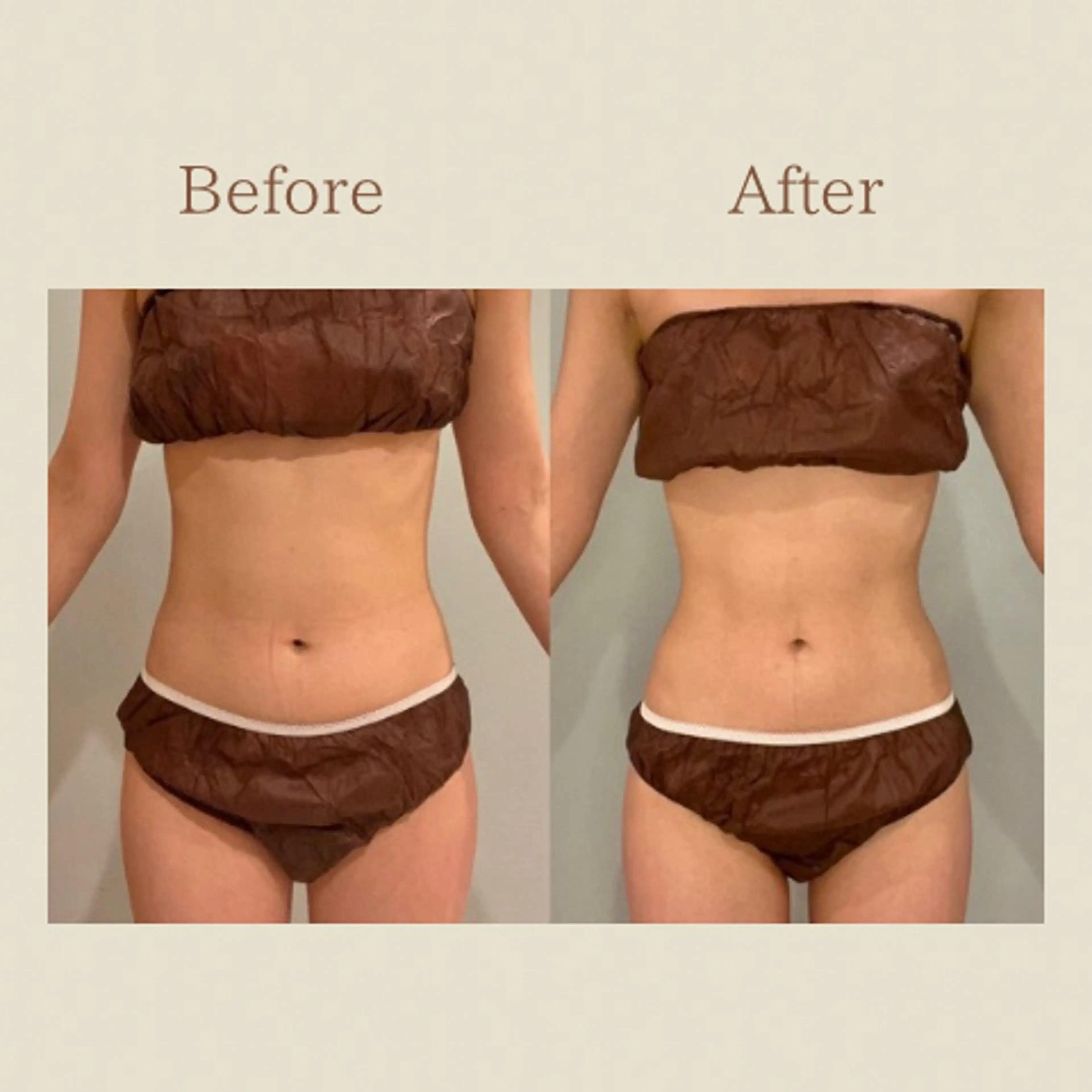 お腹痩せエステ Flat BELLY 恵比寿所属・【腸もみ/冷却痩身】 お腹エステ/恵比寿のエステ・リラクイメージ