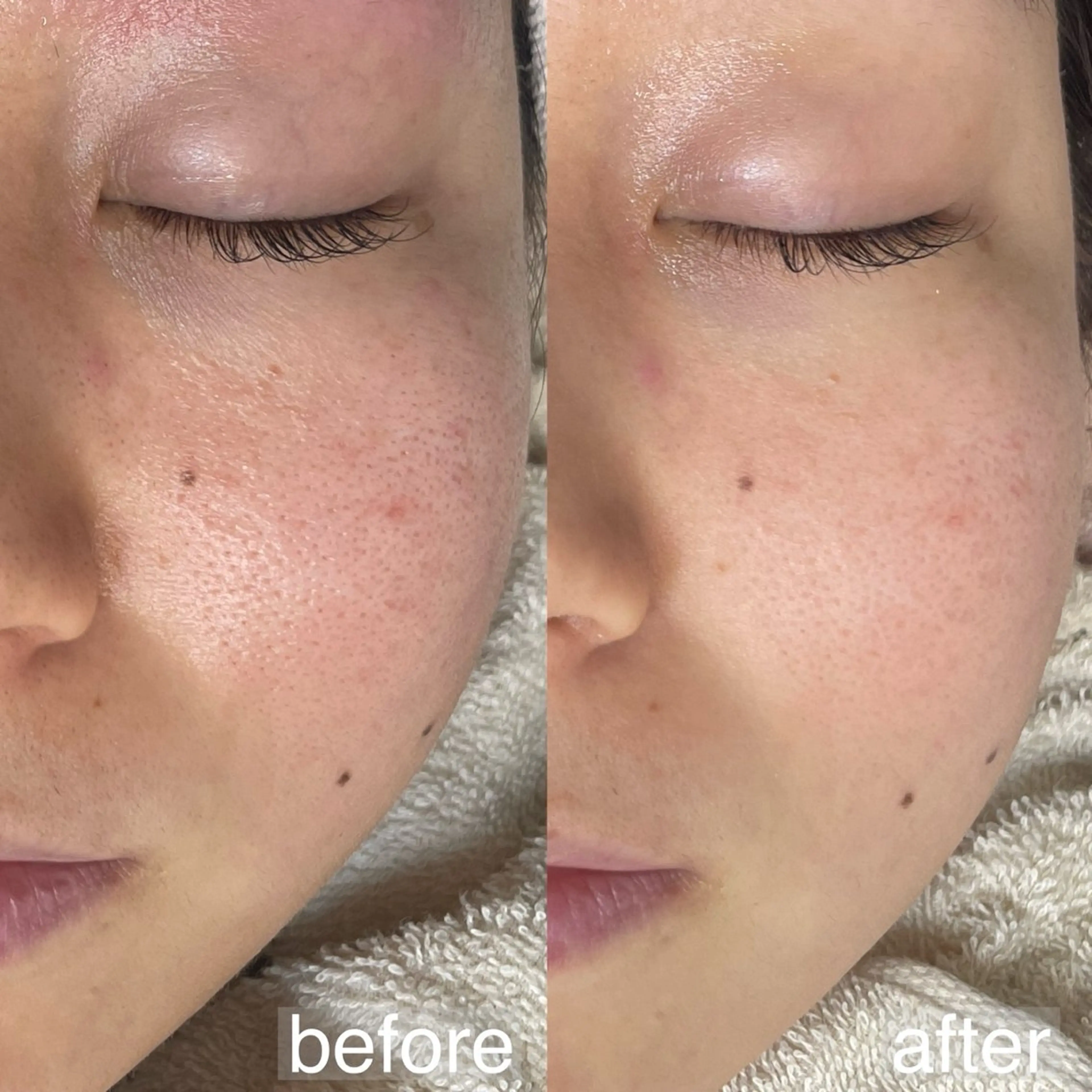 アイブロウ&フェイシャルサロンa‘lm所属・WAX脱毛/肌質改善 眉毛とお肌のサロンのエステ・リラクイメージ