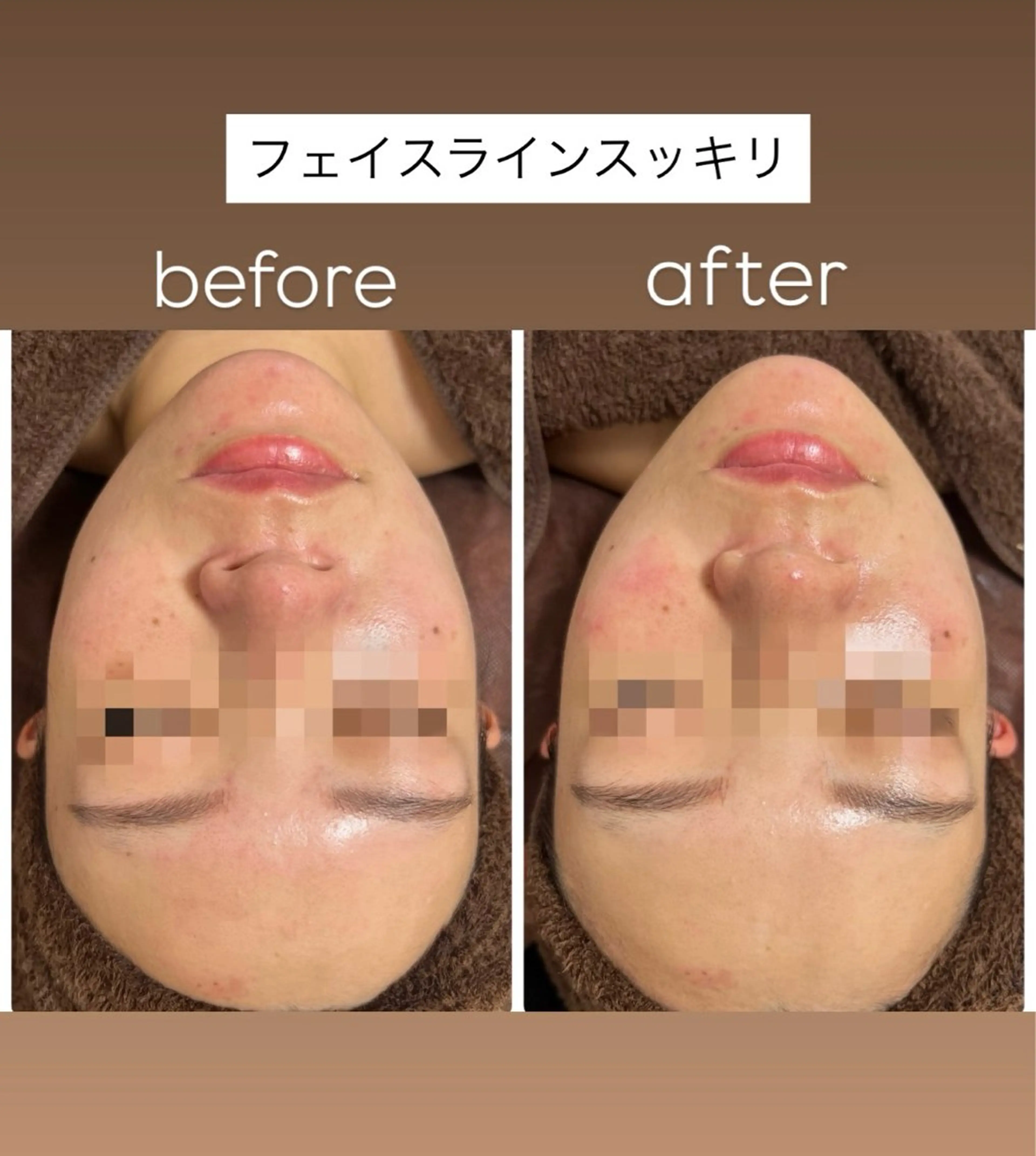 艶肌/角質ケア フェイシャルワックスのエステ・リラクイメージ