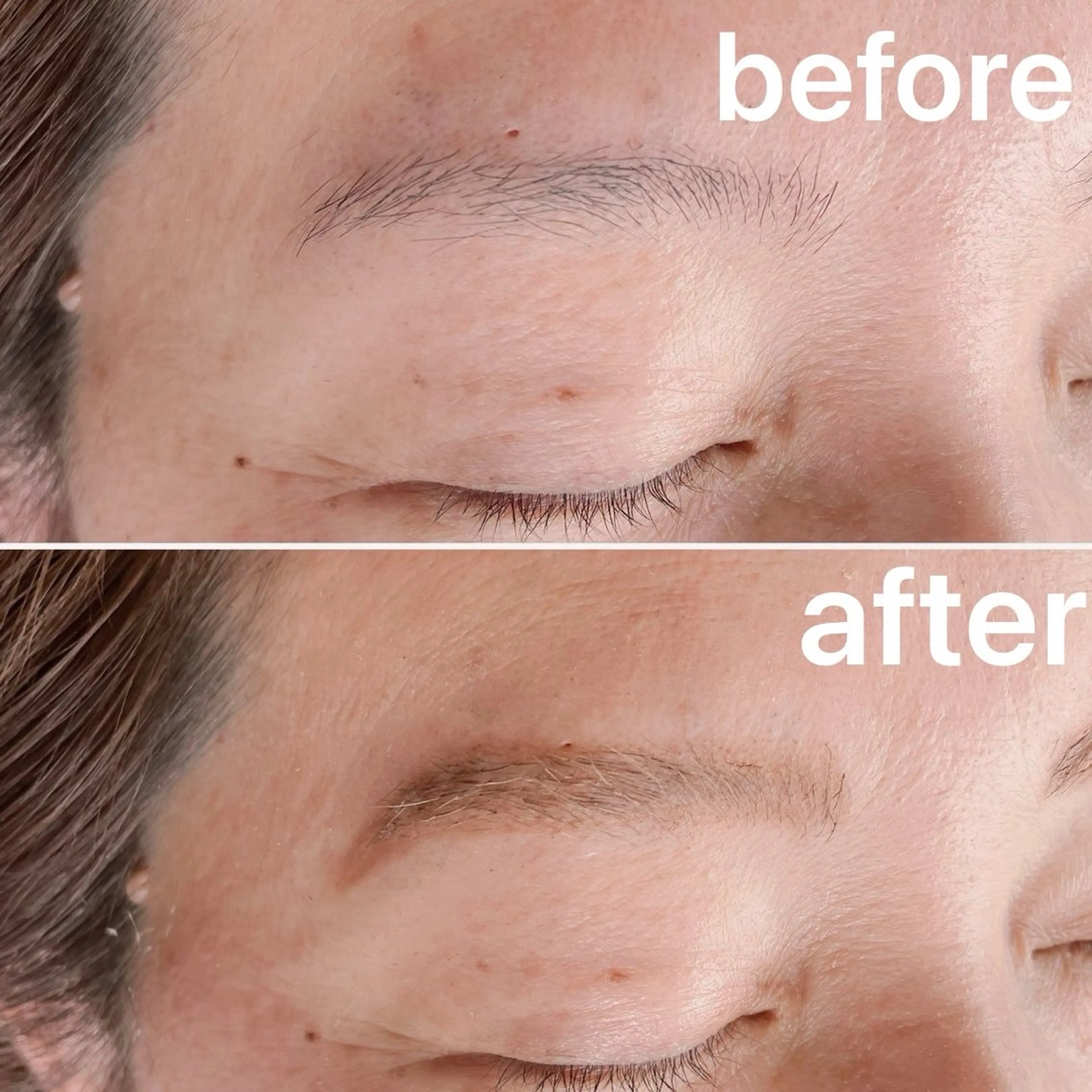 アイブロウ ハリウッドブロウリフト その他(アイブロウ) evergreen /眉毛•耳つぼのエステ・リラクイメージ