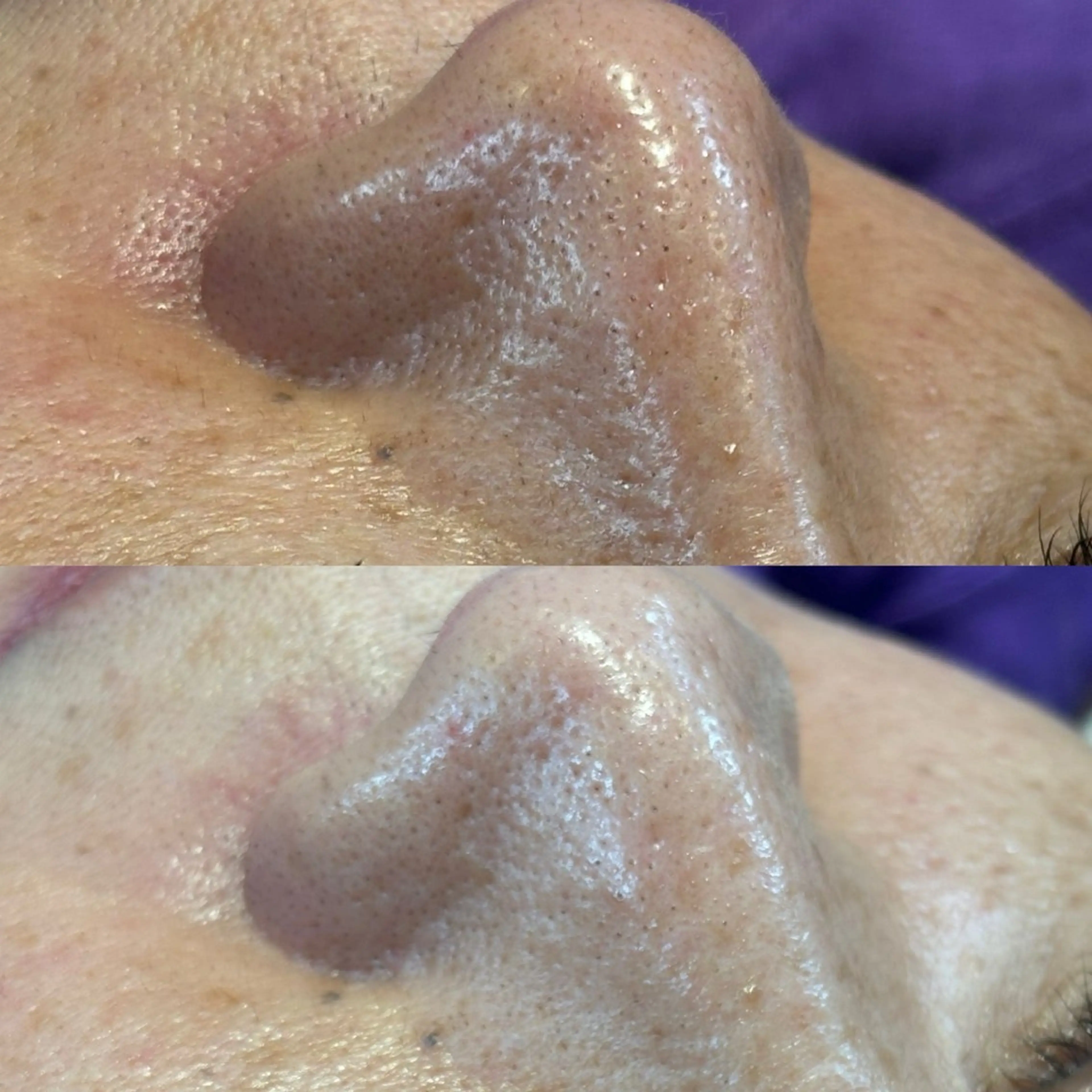 エステ By color  EYE&NAIL所属・BY  COLOR eyedesinのマツエク・マツパデザイン