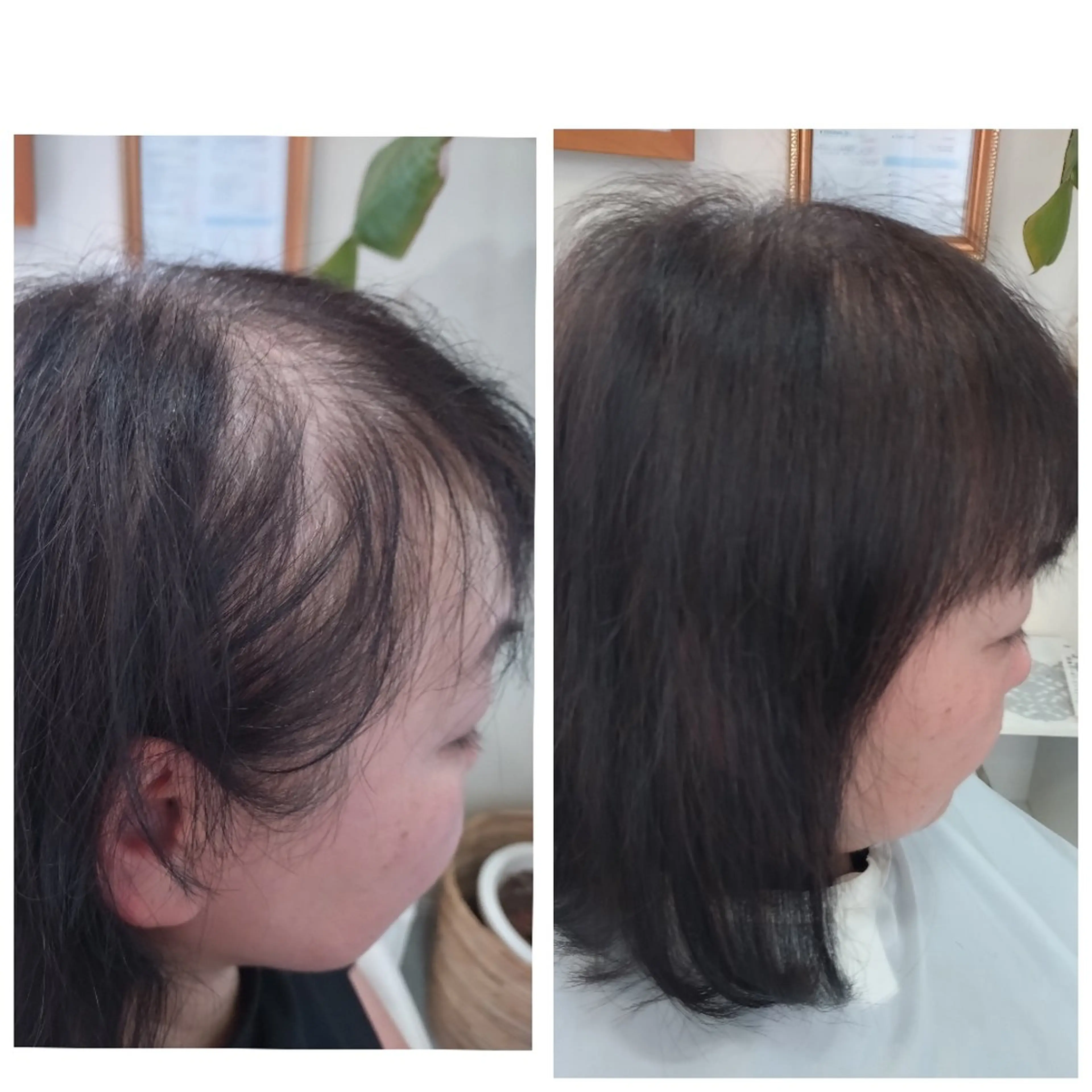 ミニモ価格❗薄毛対策◇お洒落【増毛エクステ】お試し200本の写真