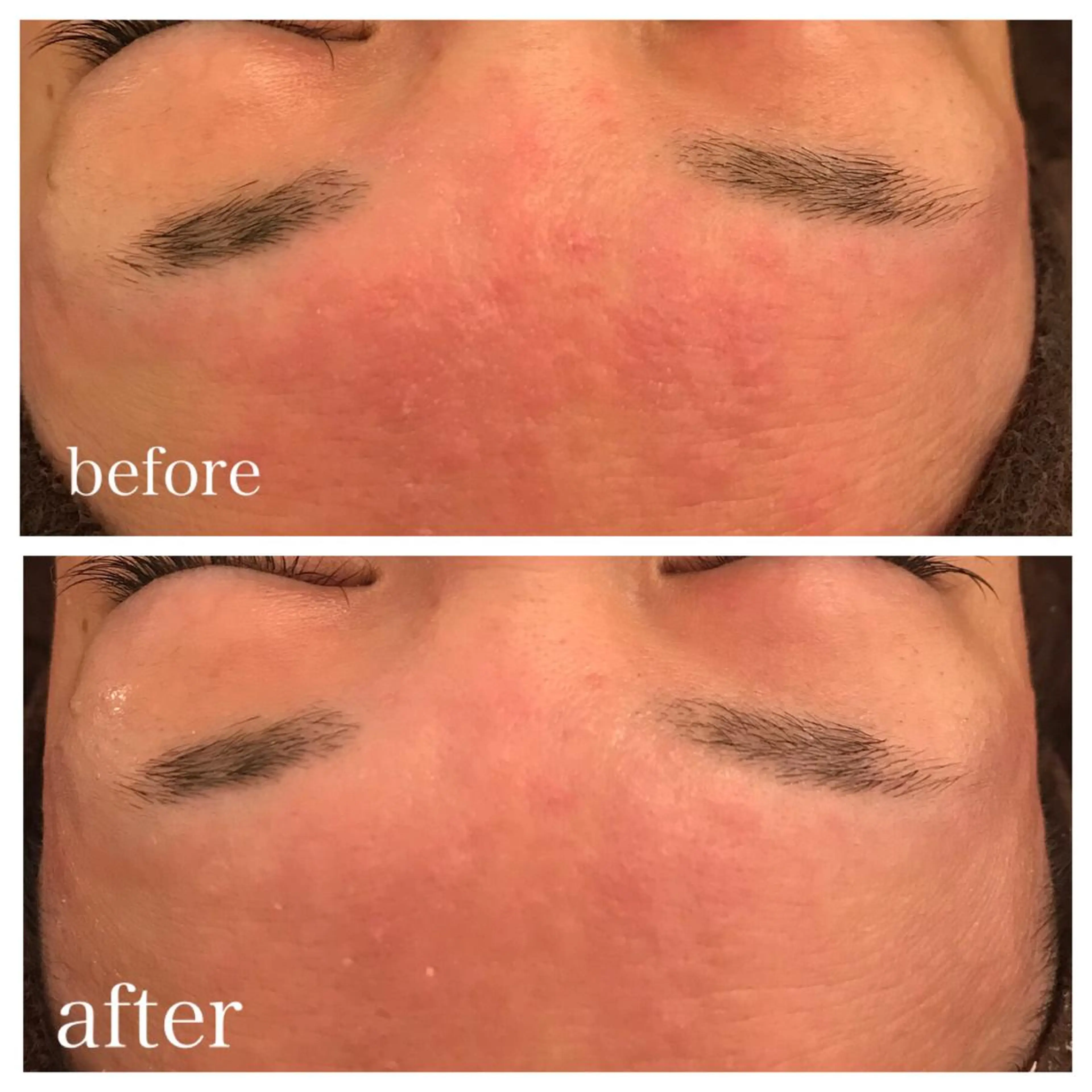 ミディアム エステ リラク ニキビ跡専門サロン Ａｉｎａのエステ・リラクイメージ