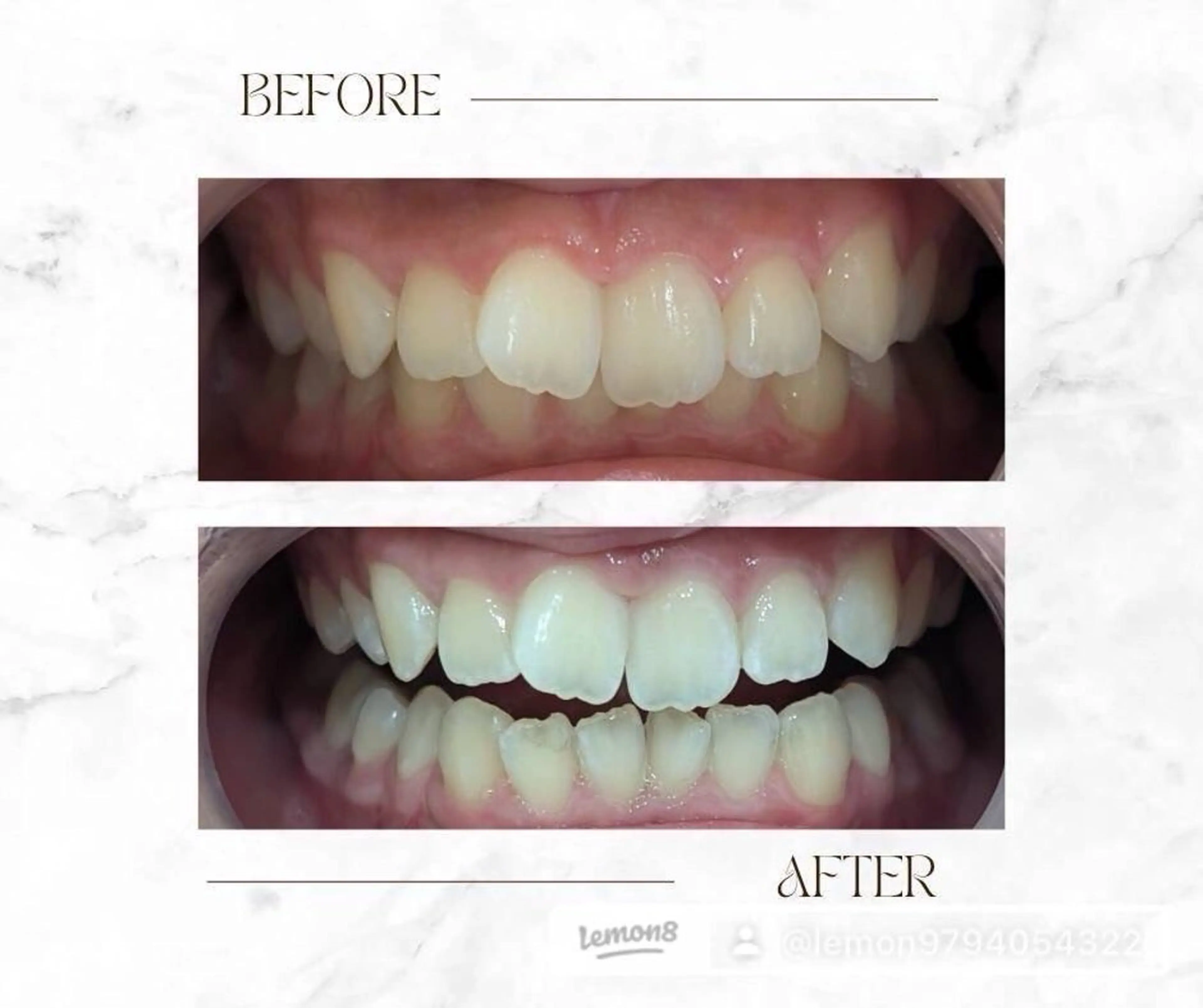 BITSUPRESS 小川のその他イメージ