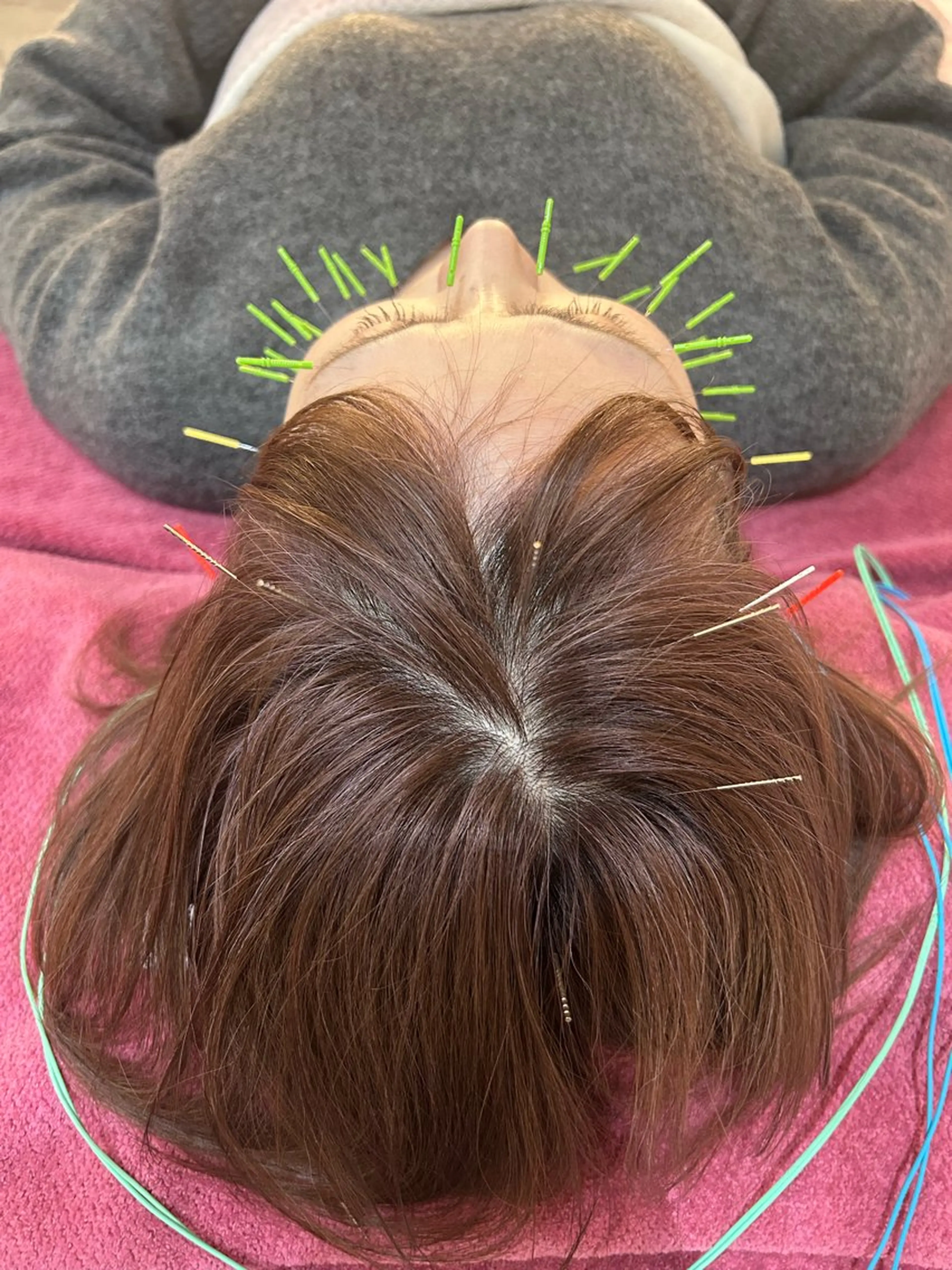 エステ リラク 美容鍼灸女性専用 りんご鍼灸治療院のエステ・リラクイメージ