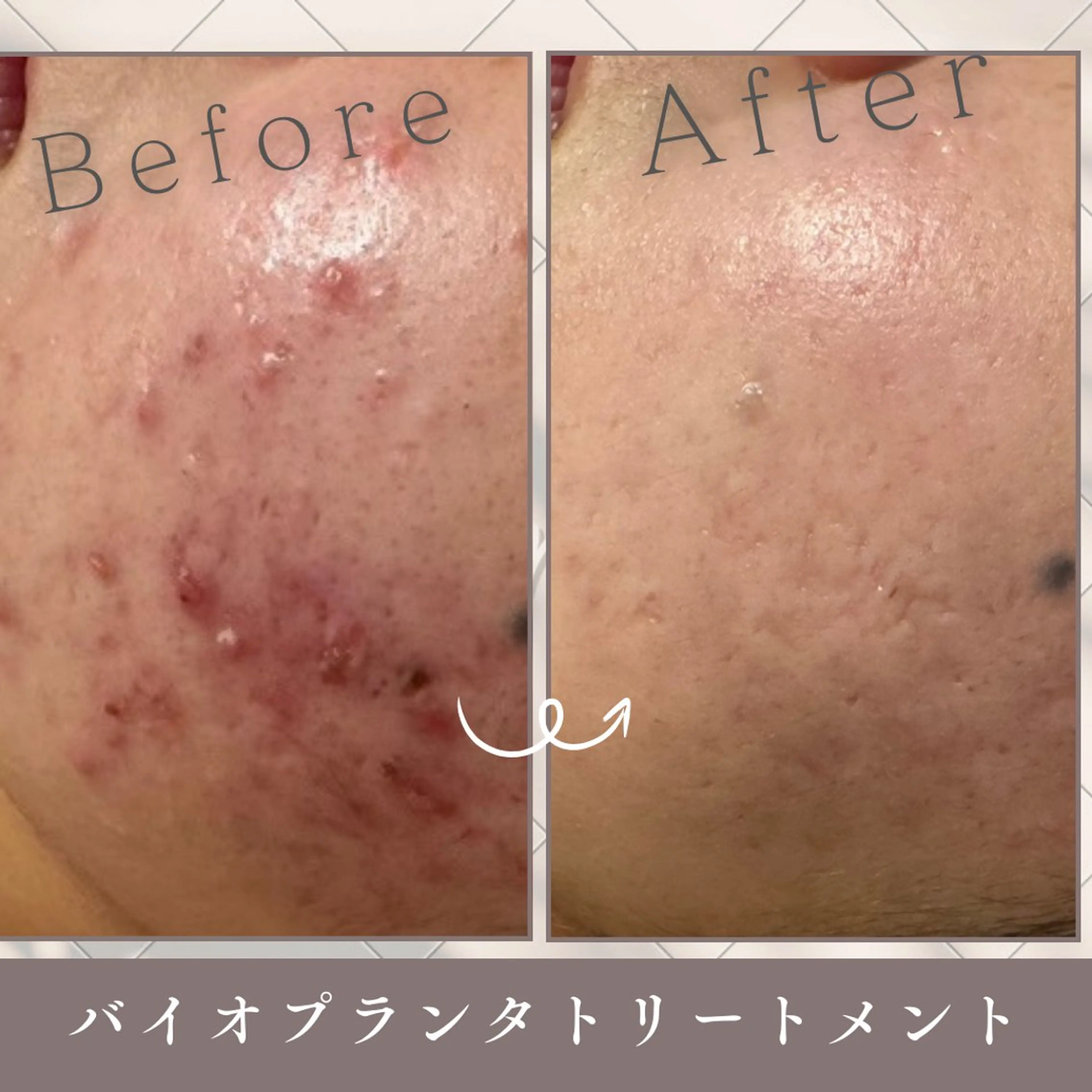 Beauty&skin Dahlia所属・ダリア 盛岡店のエステ・リラクイメージ