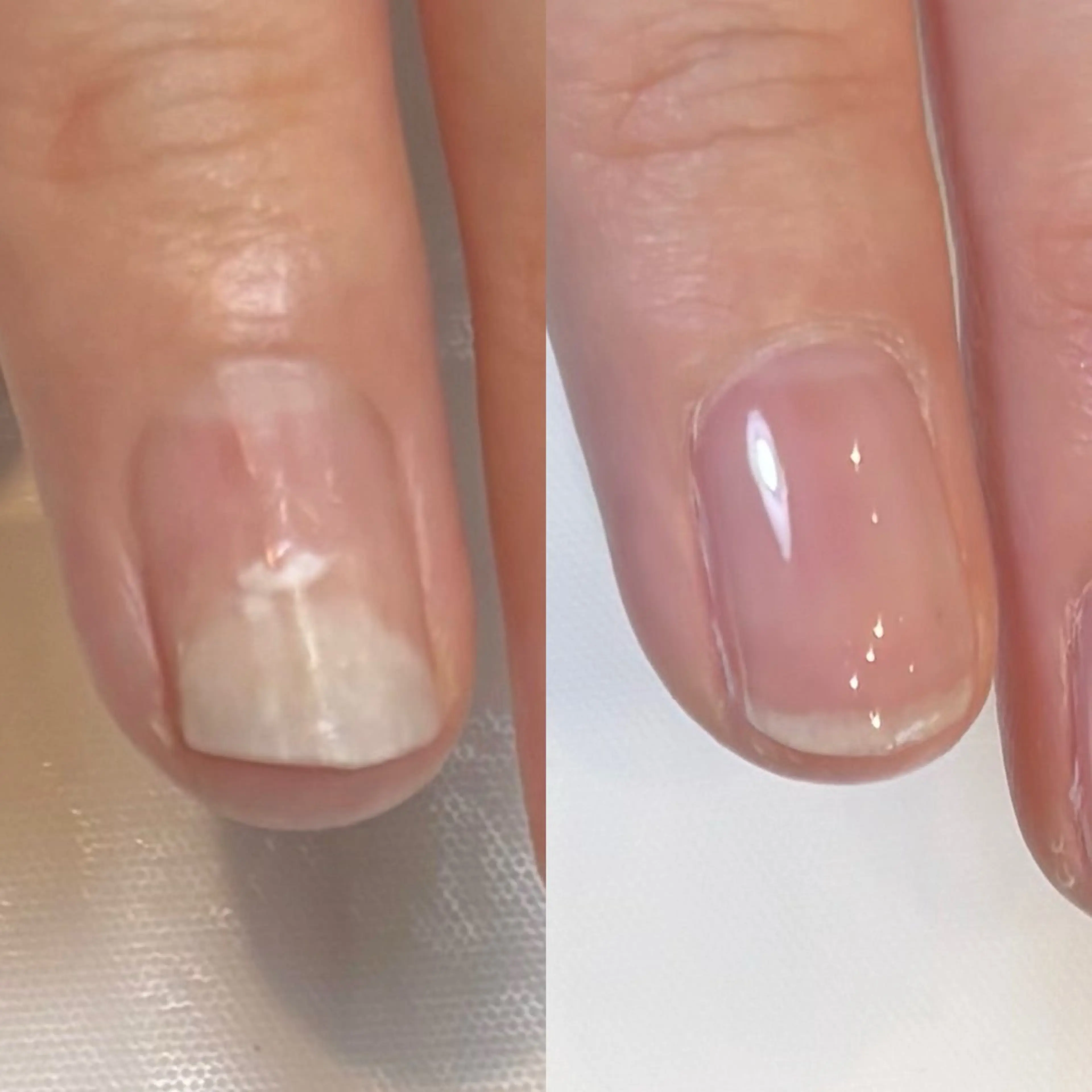 オーナー津蔵とスタッフが担当する『ハンドの剥離解消メニュー』 無料　※必ず補足説明をご確認ください。の写真