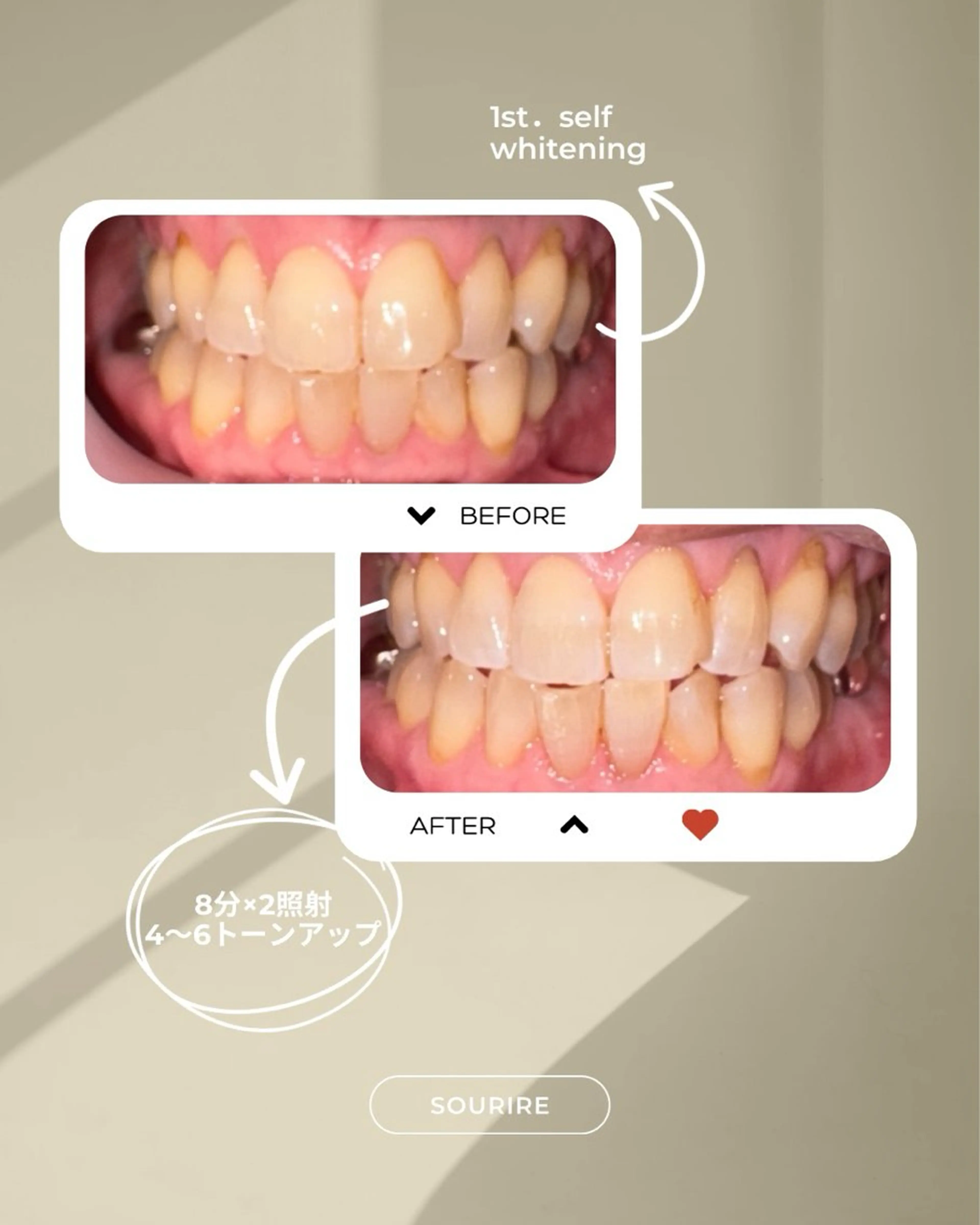 セルフホワイトニングサロンsourire所属・加藤 愛菜のその他イメージ