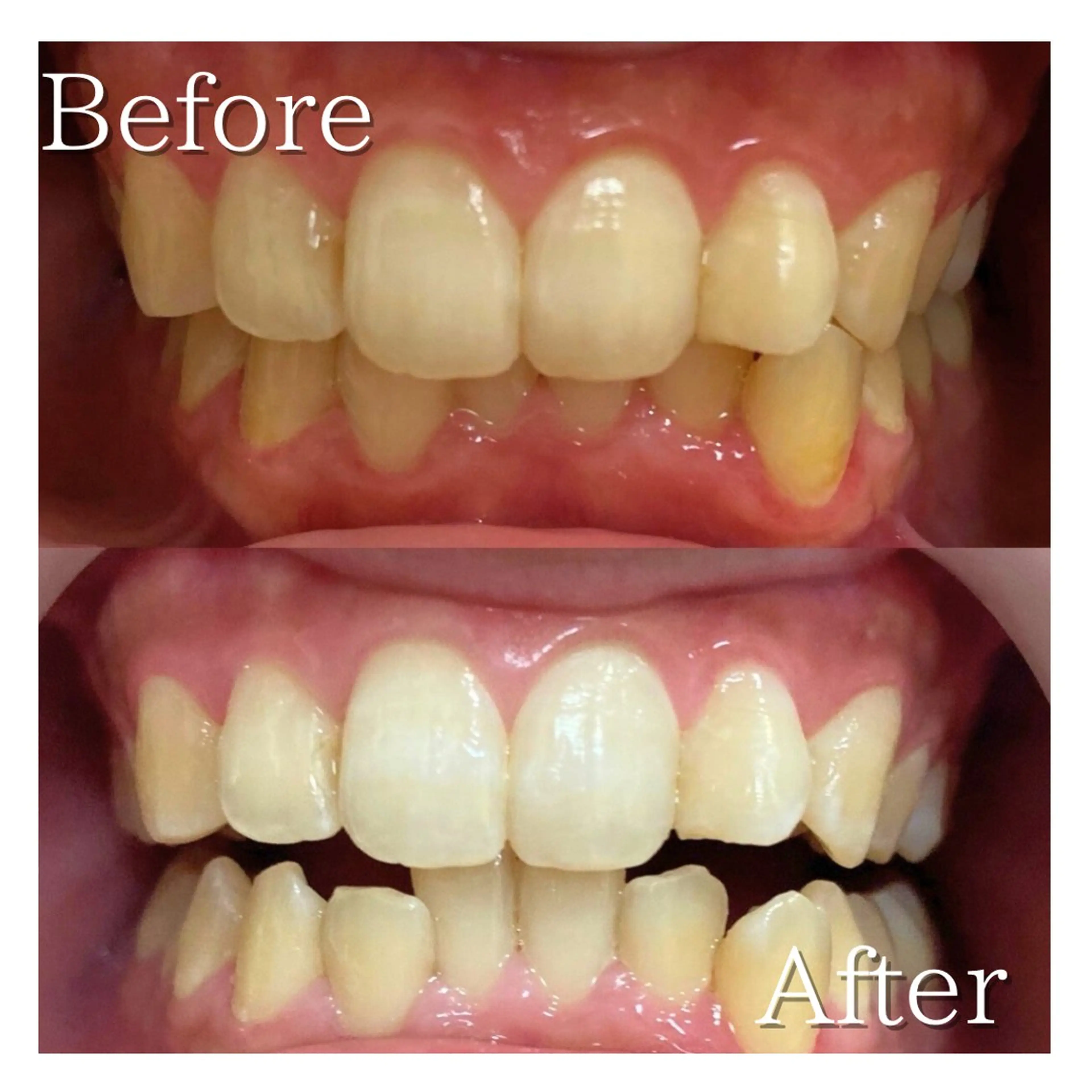 LBSホワイトニング 🌐岡山店のその他イメージ