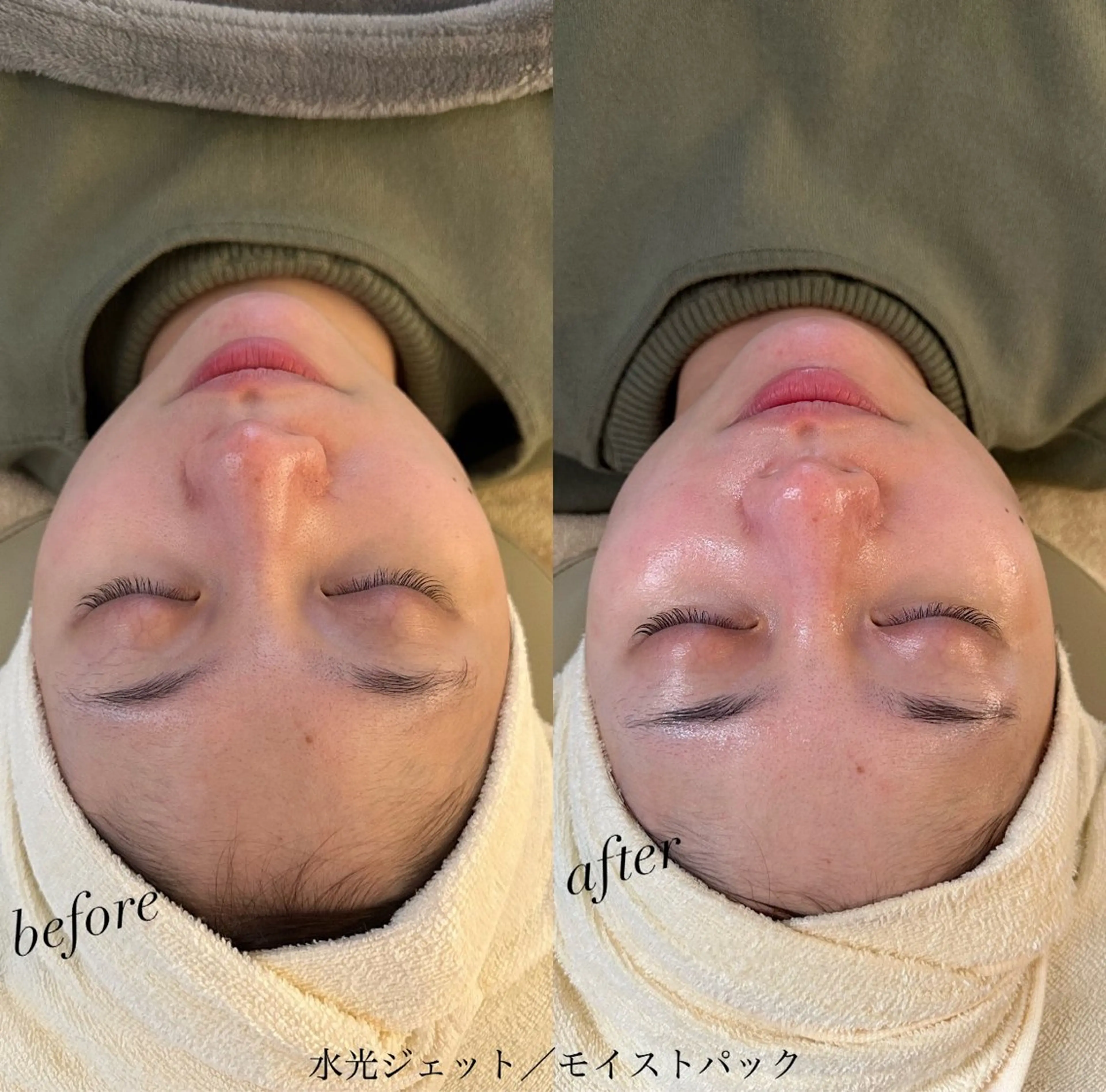 うなじ脱毛/美肌脱毛 LABELのエステ・リラクイメージ