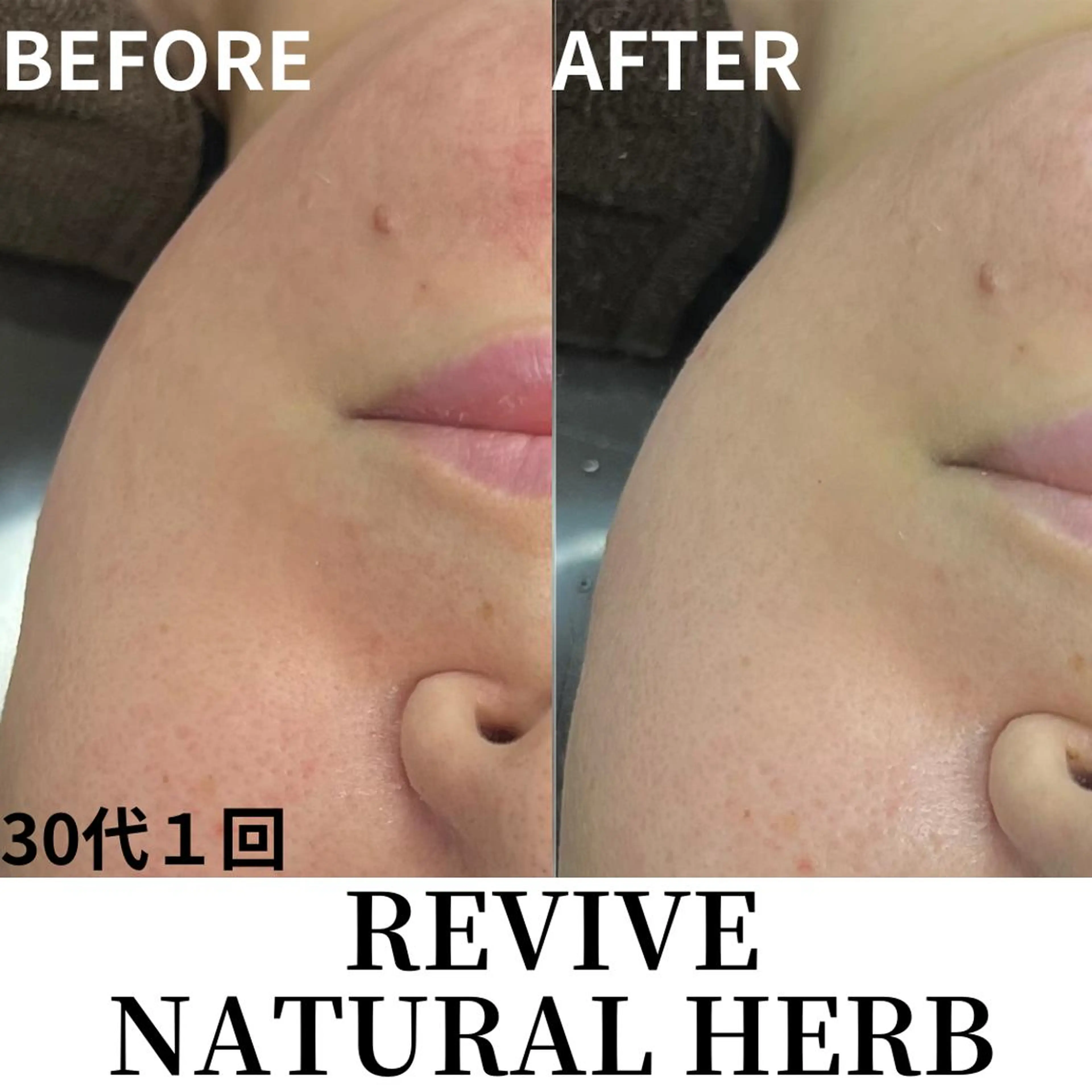 エステ PLACE梅田堂山店 【肌質改善/ハーブ】のエステ・リラクイメージ