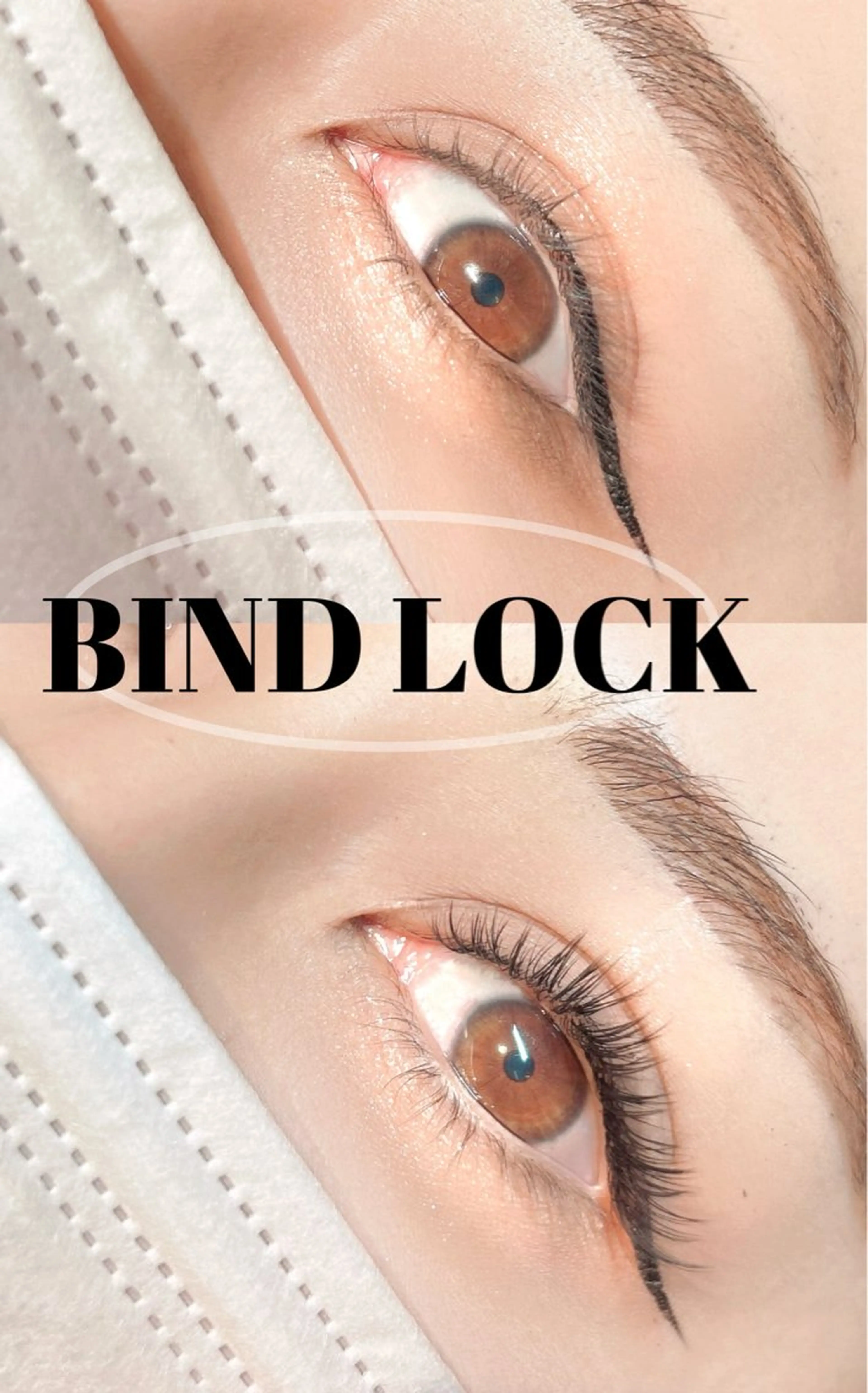 バインドロック70束（140本）初回オフ無料の写真