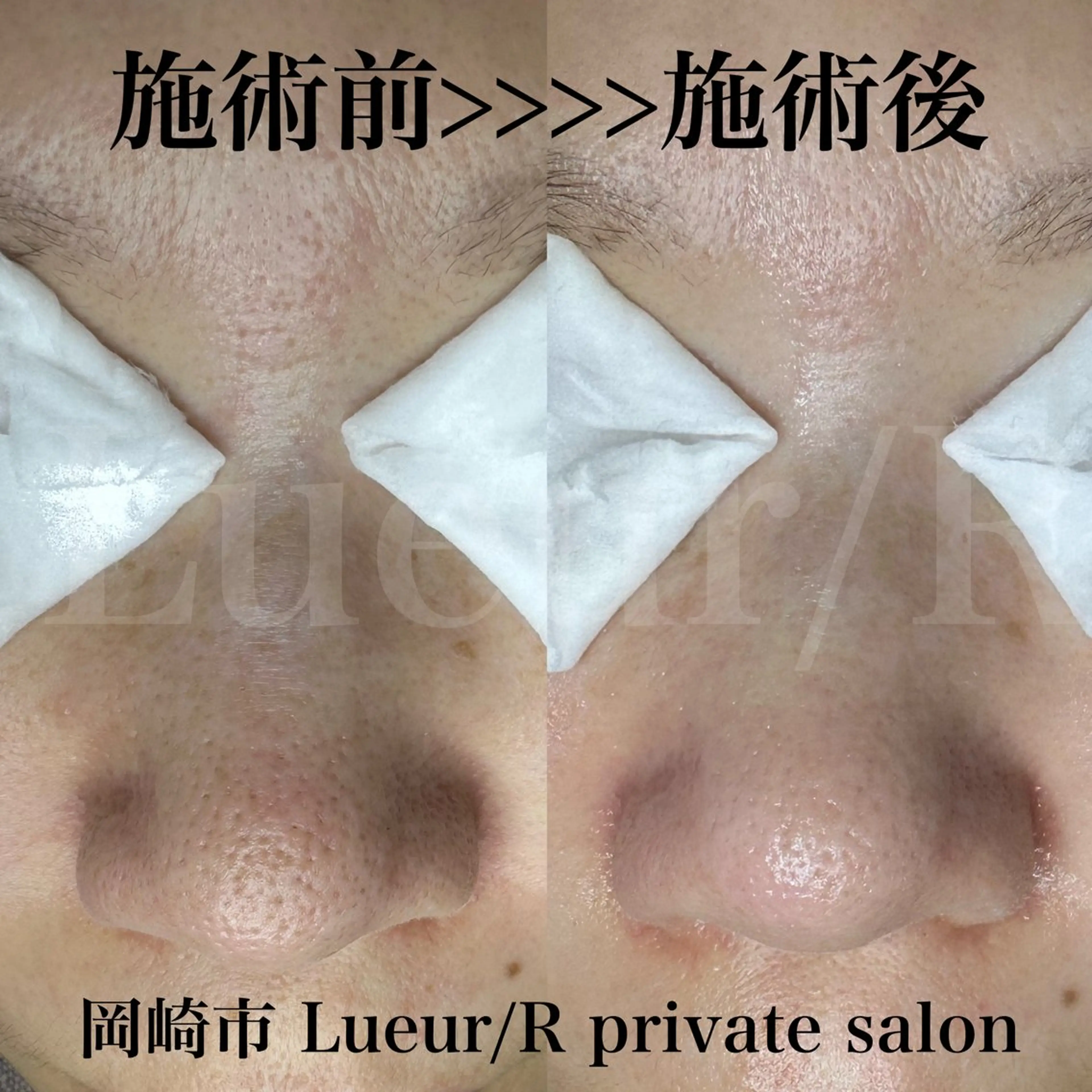 エステ 大久保 里奈のエステ・リラクイメージ