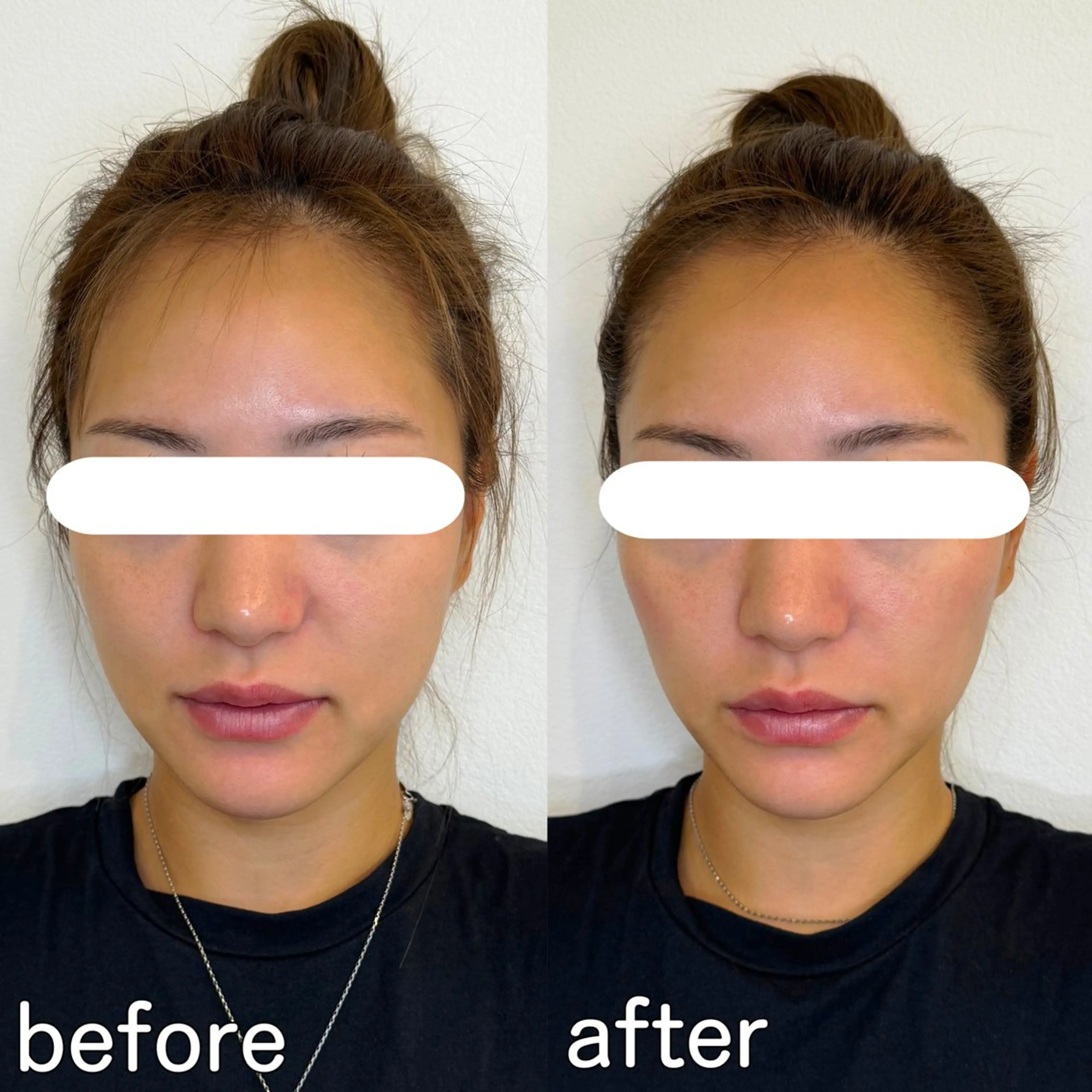 小顔矯正&美容整体 整え屋REDオーナーのエステ・リラクイメージ