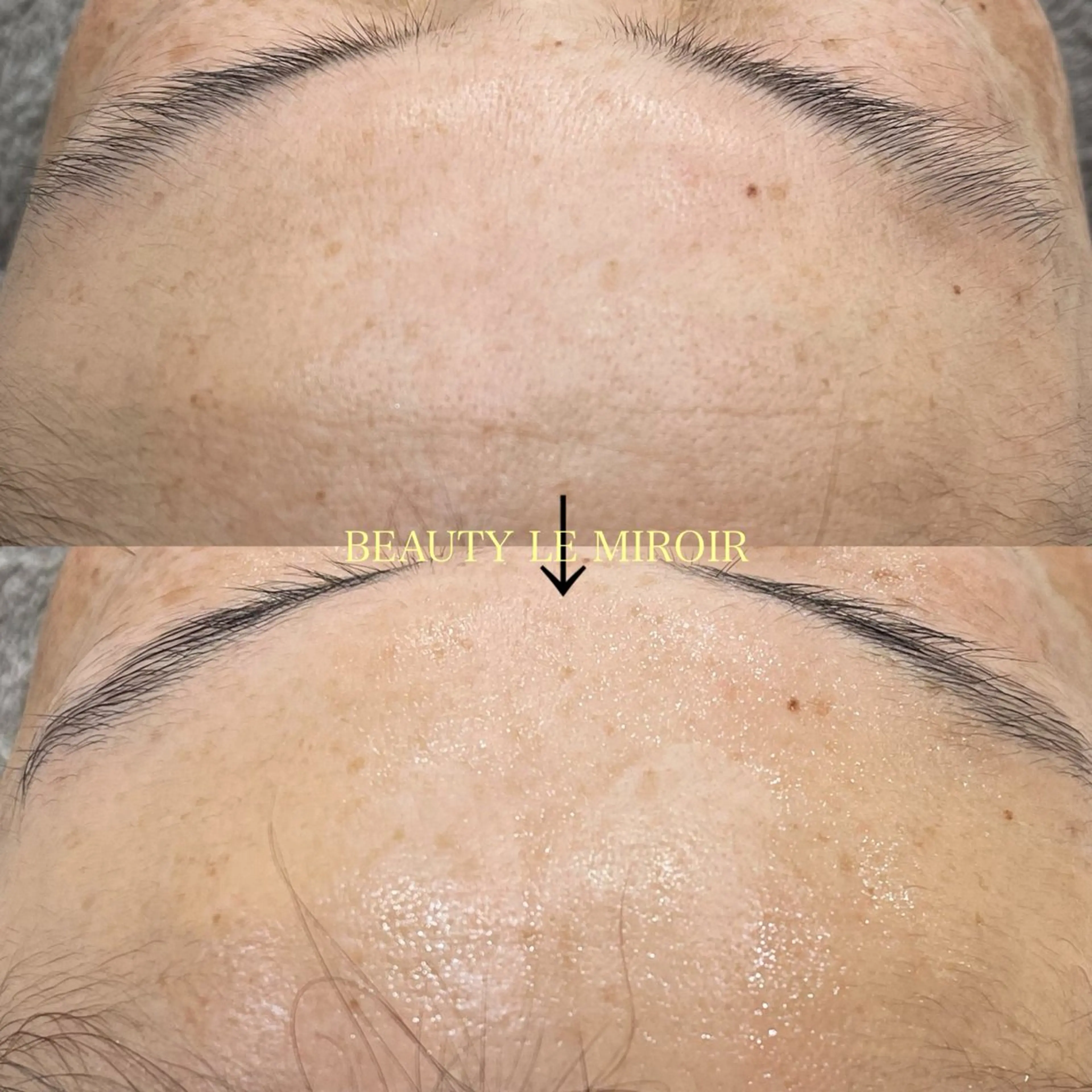 エステ ビューティー ミロワールのエステ・リラクイメージ