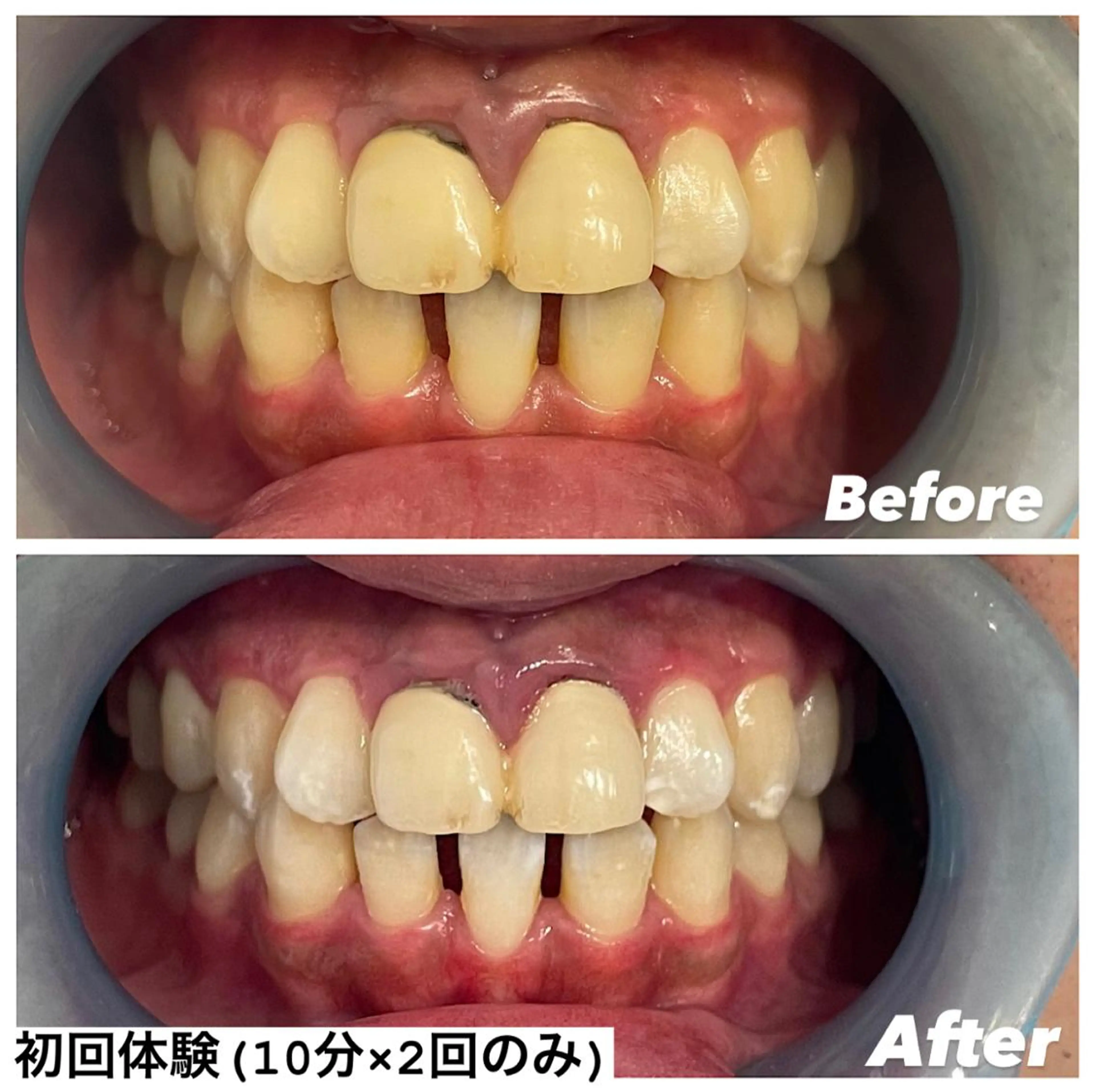 その他 ホワイトニング専門店 Hi-Whiteのその他イメージ