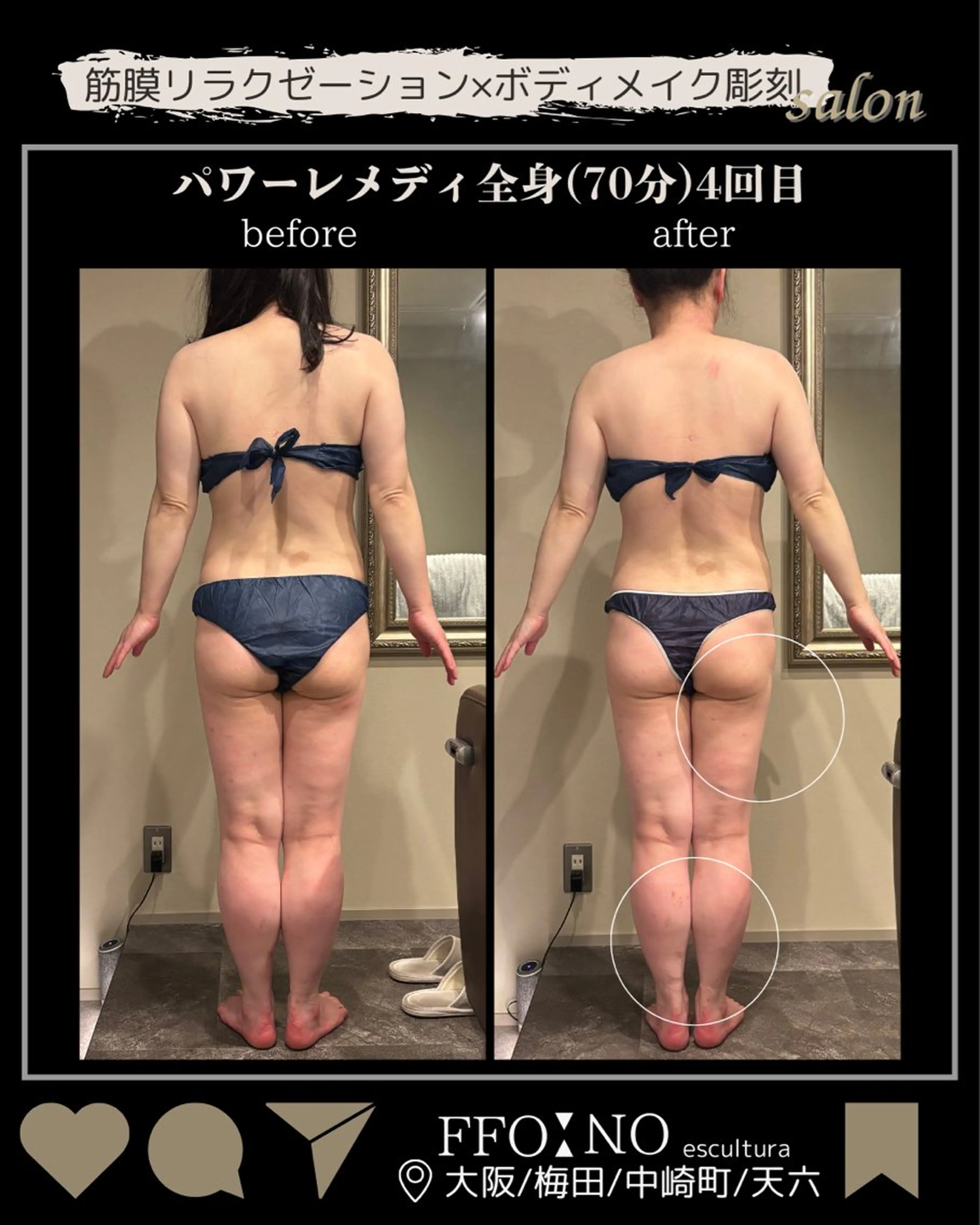 オフ:オン所属・オフ:オン 全身筋膜マッサージのエステ・リラクイメージ