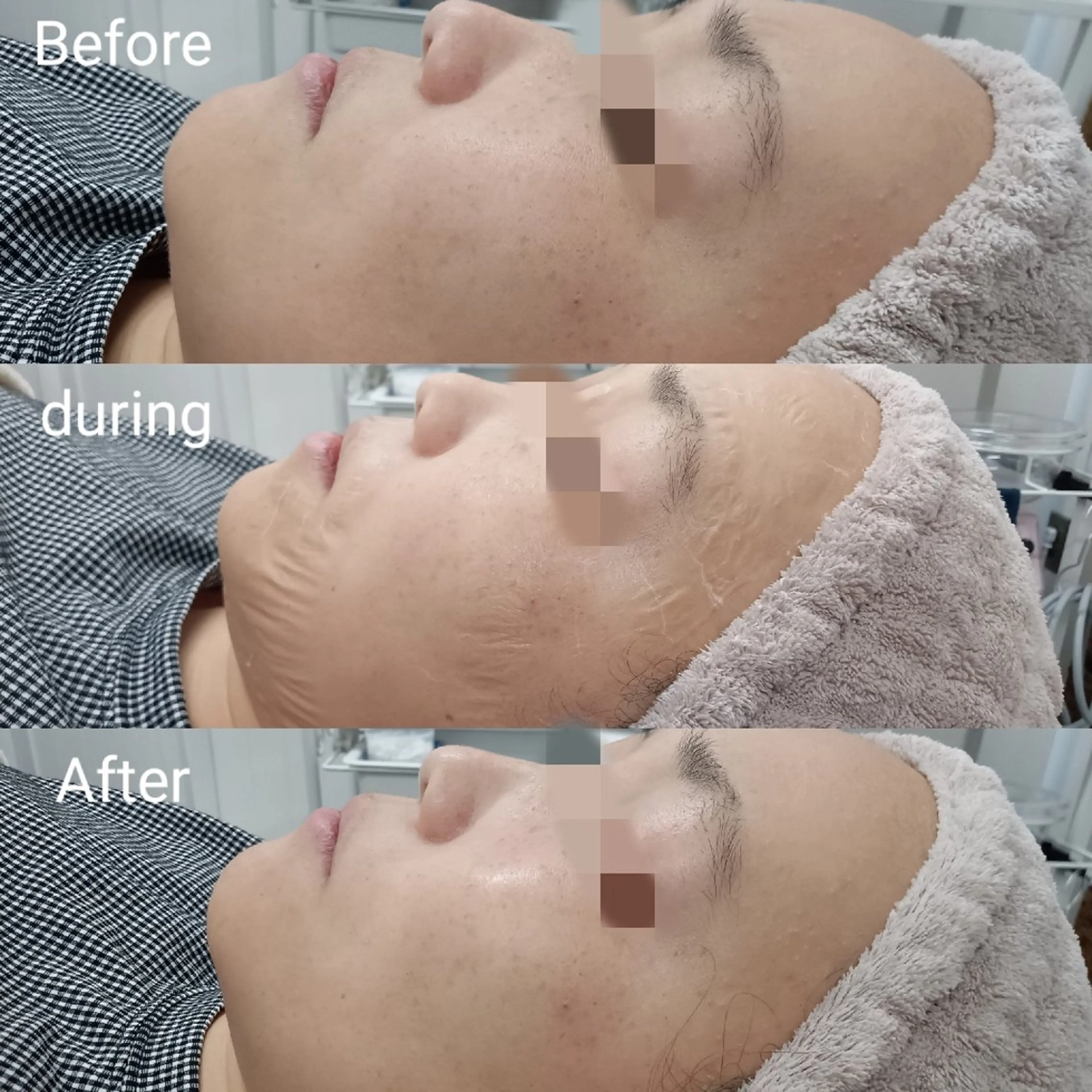 肌質改善Beauty salon Renのエステ・リラクイメージ