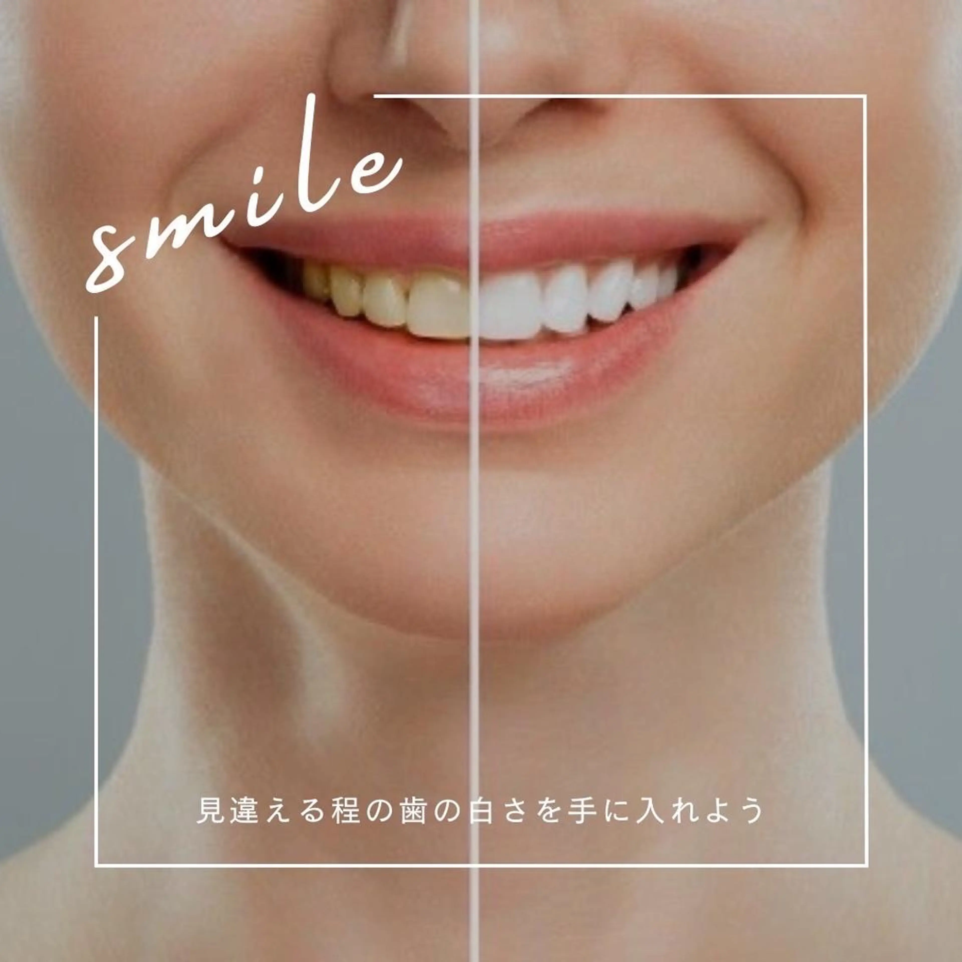 メンズ エステ リラク ホワイトニング ショップ本八幡店のエステ・リラクイメージ