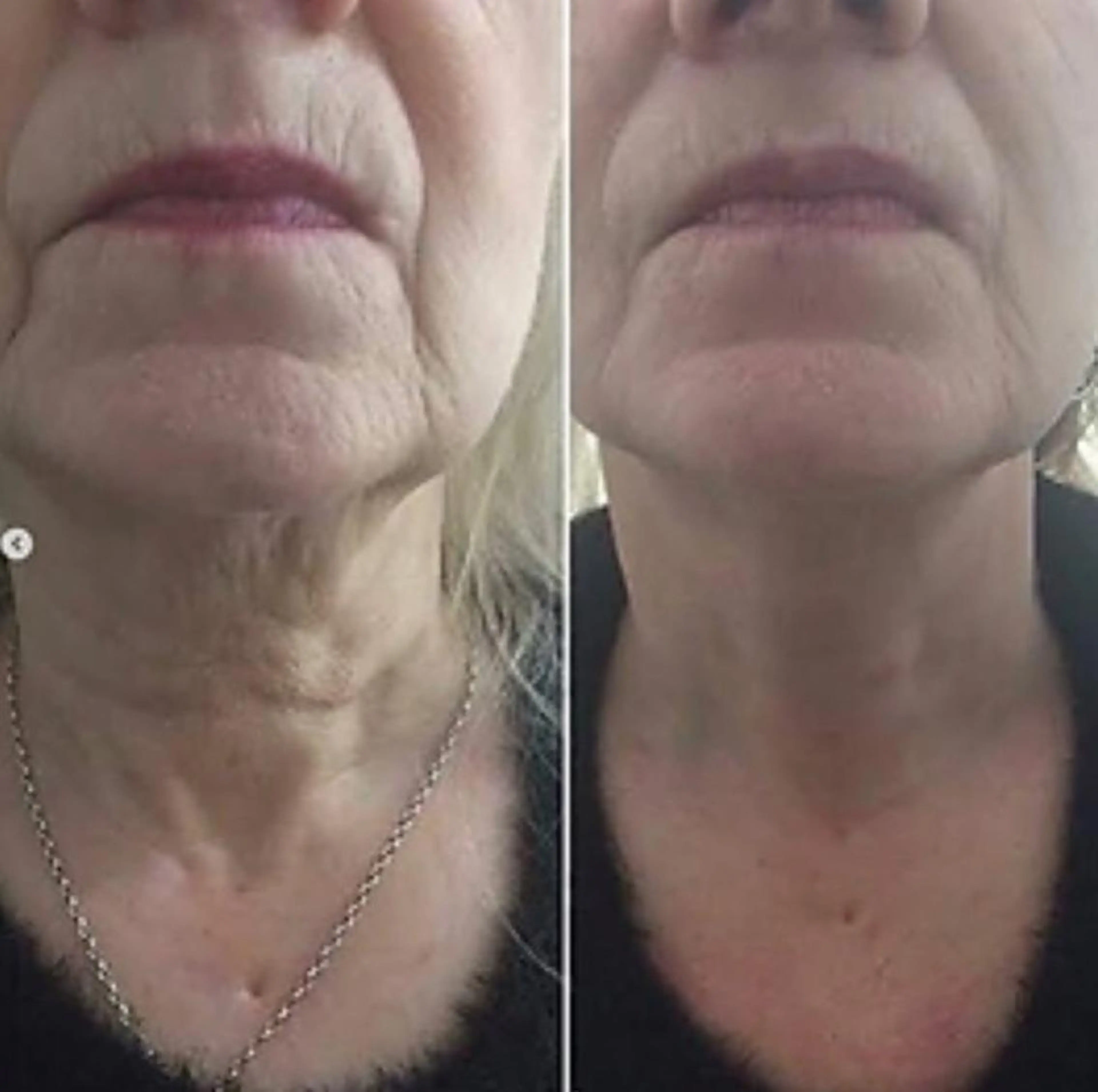 セルフエステ ALL in ONE所属・1組貸切 セルフエステのエステ・リラクイメージ