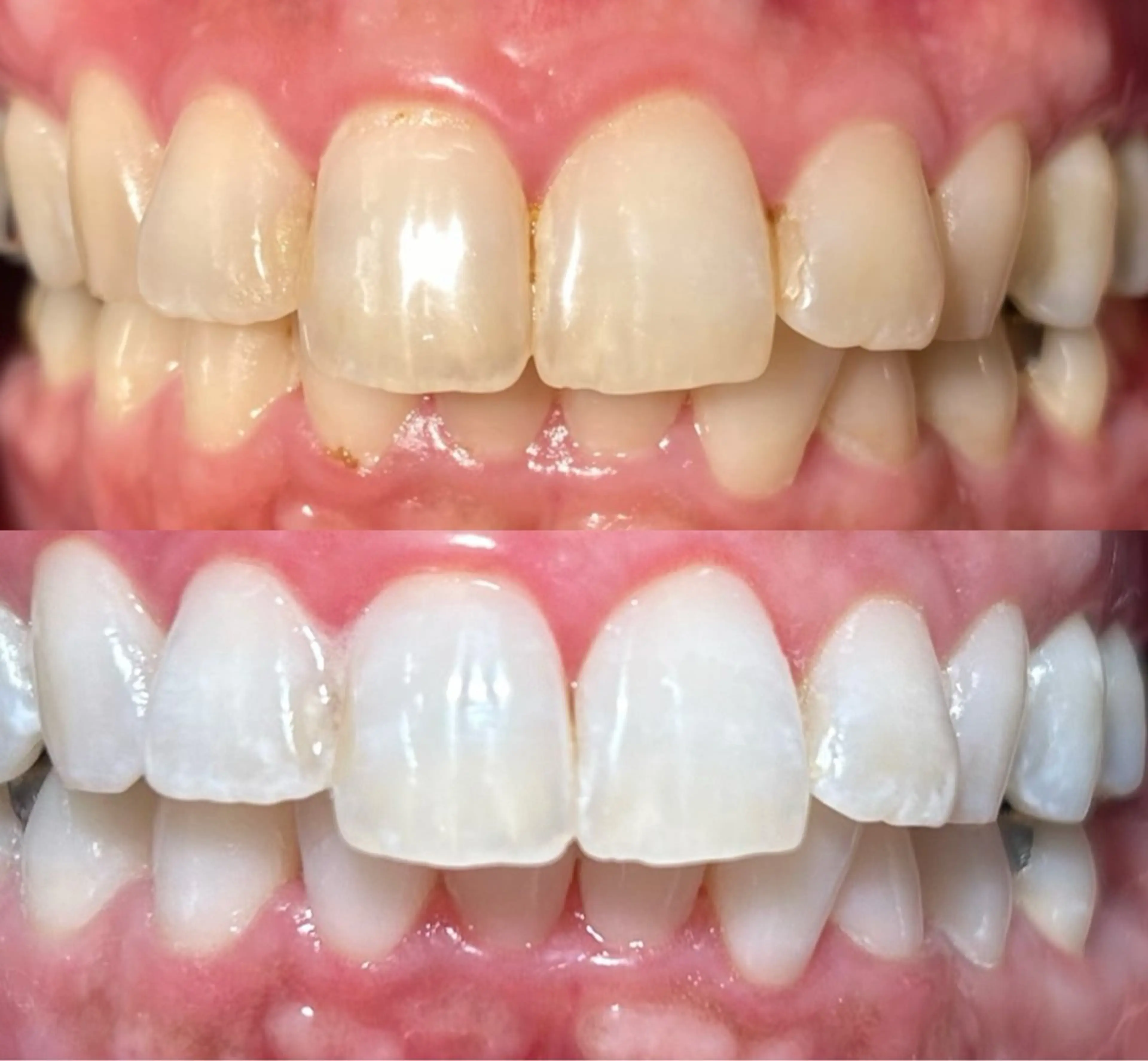 io teeth careのその他イメージ