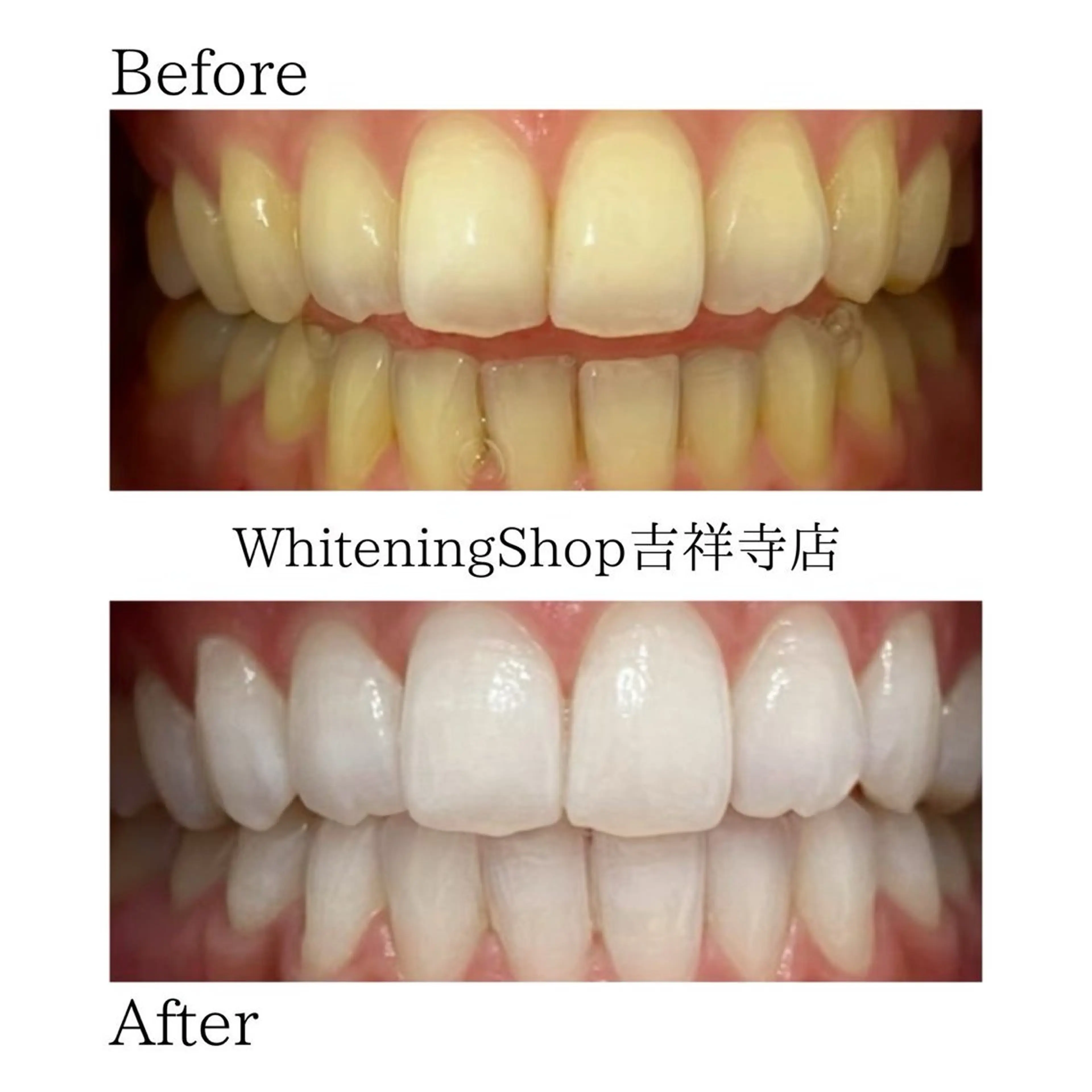 ホワイトニングショッ 吉祥寺2号店のエステ・リラクイメージ