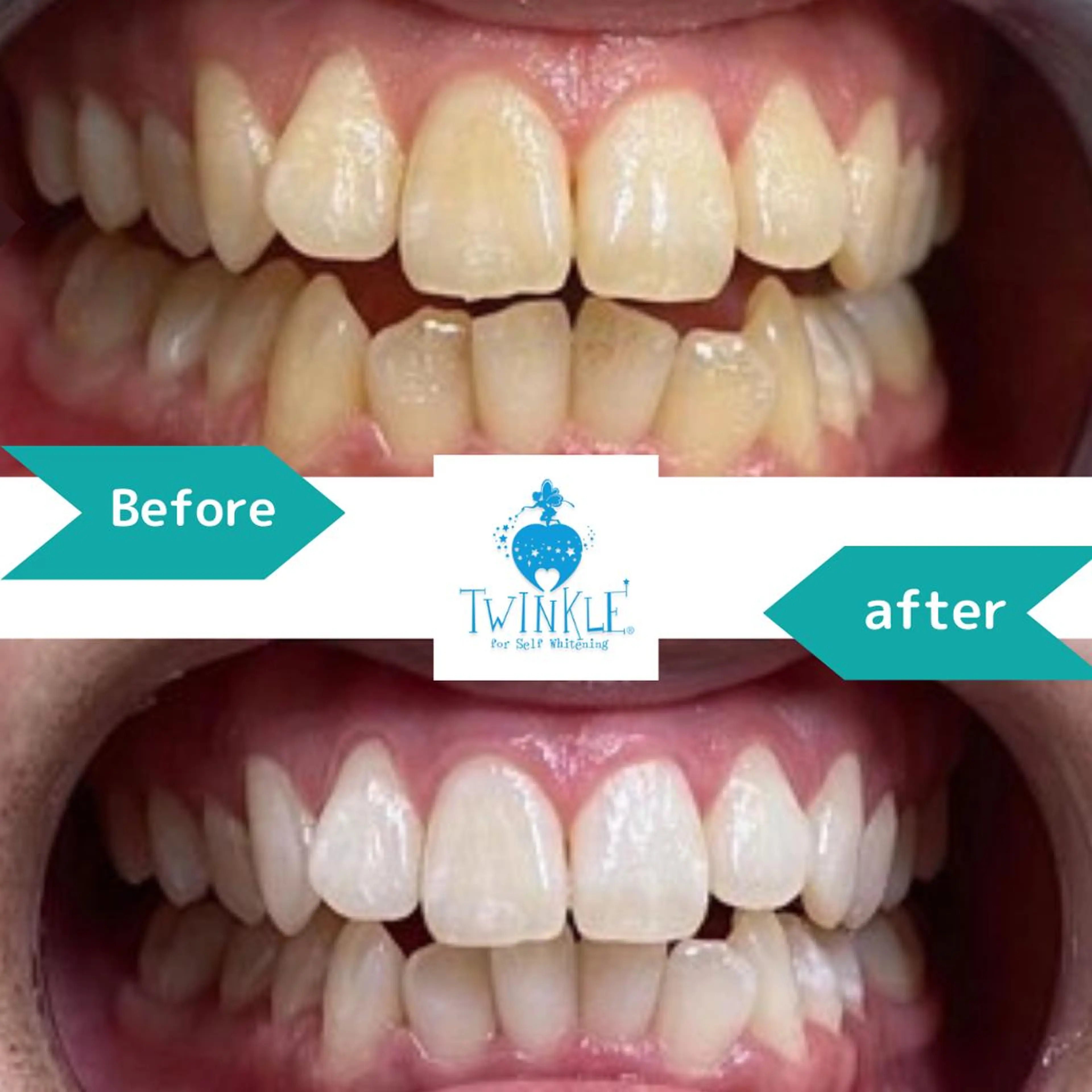 Twinkle White上尾店のエステ・リラクイメージ